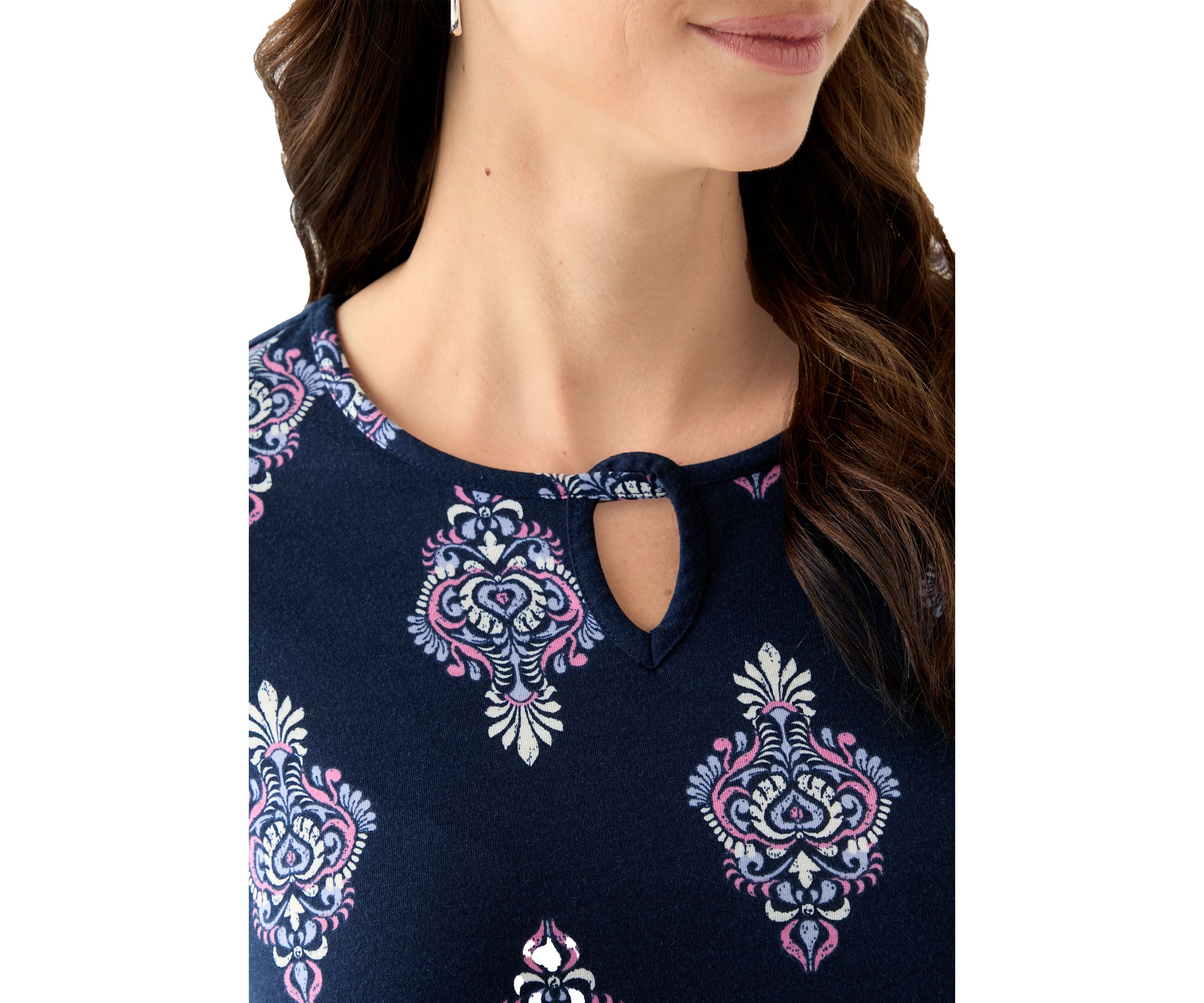 Womens Keyhole Detail Printed A-Line Top