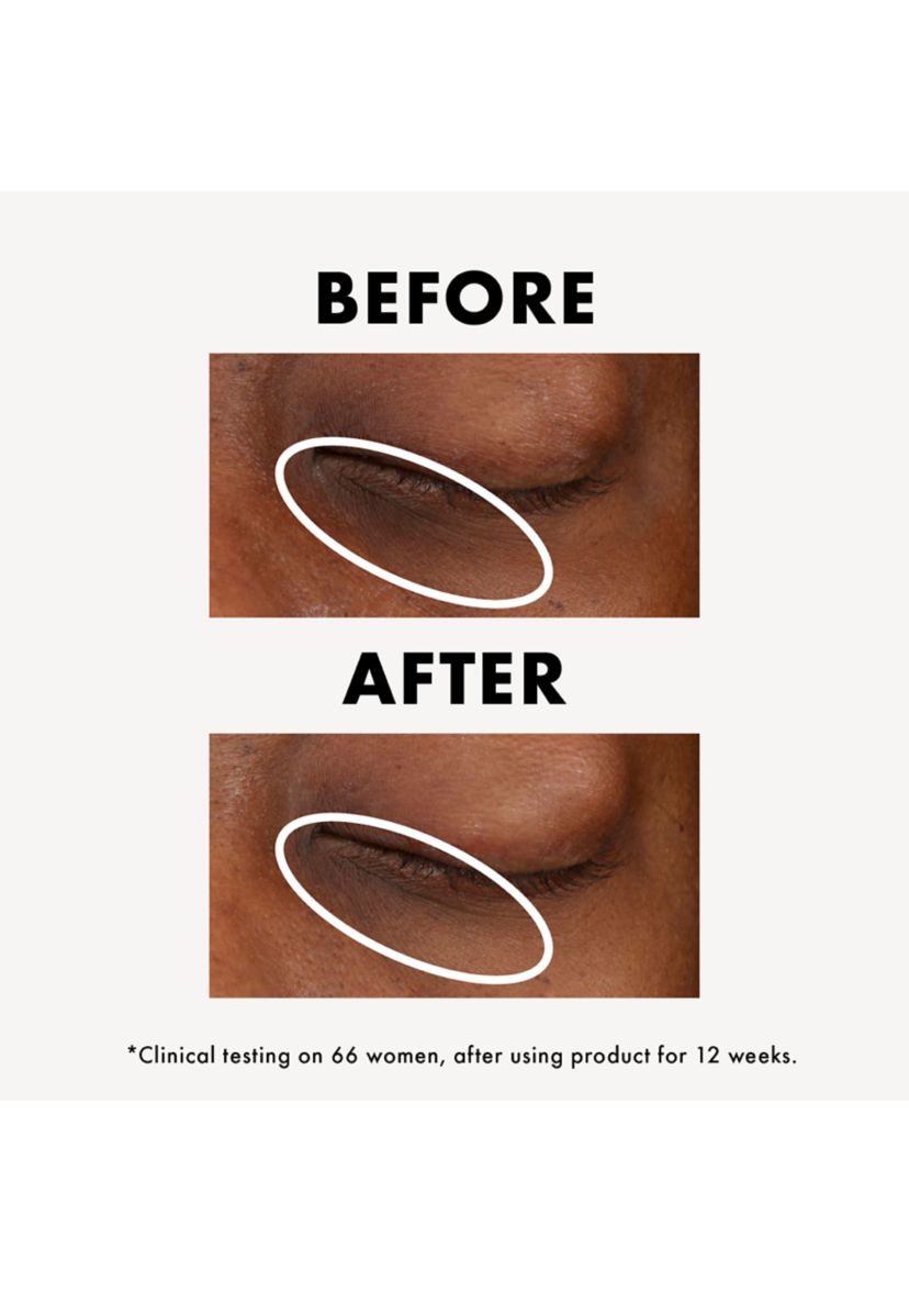GinZing™ Vitamin C & Niacinamide Eye Cream To Brighten And Depuff