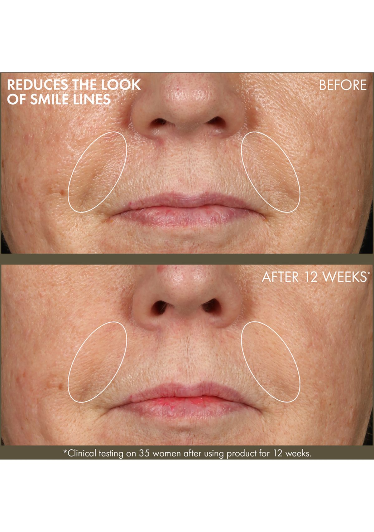 Plantscription™ Active Wrinkle Correction Serum with Retinoid