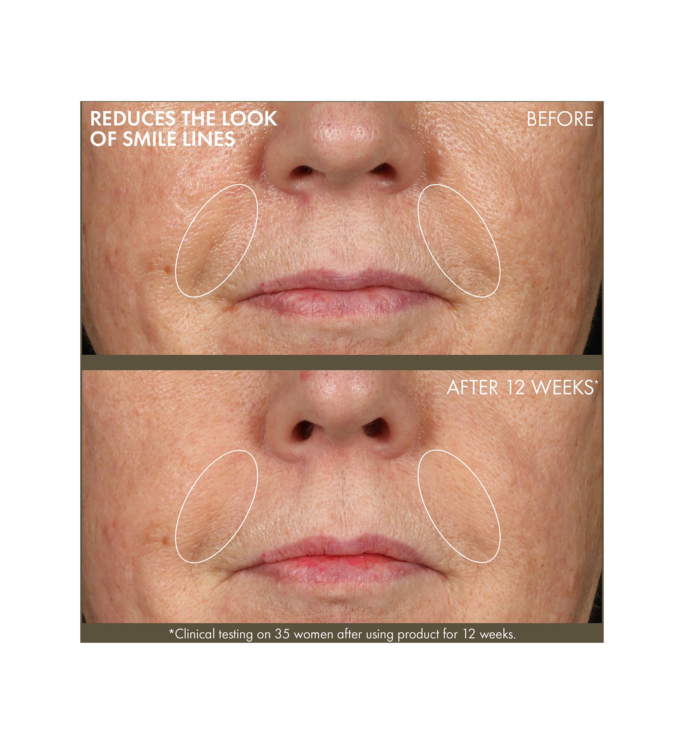 Plantscription™ Active Wrinkle Correction Serum with Retinoid