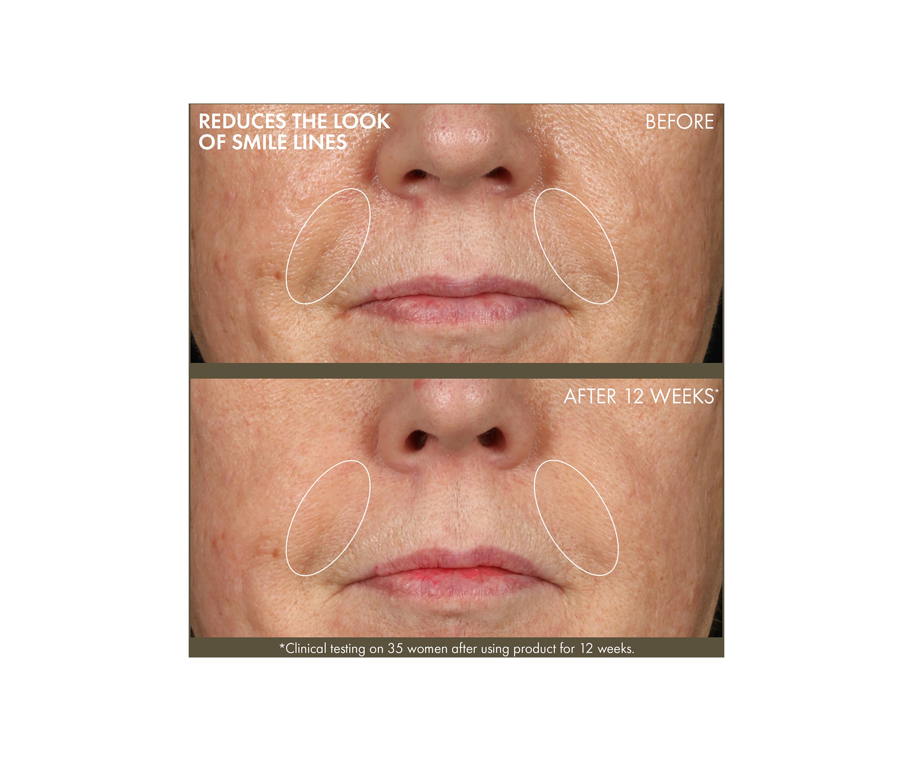 Plantscription™ Active Wrinkle Correction Serum with Retinoid