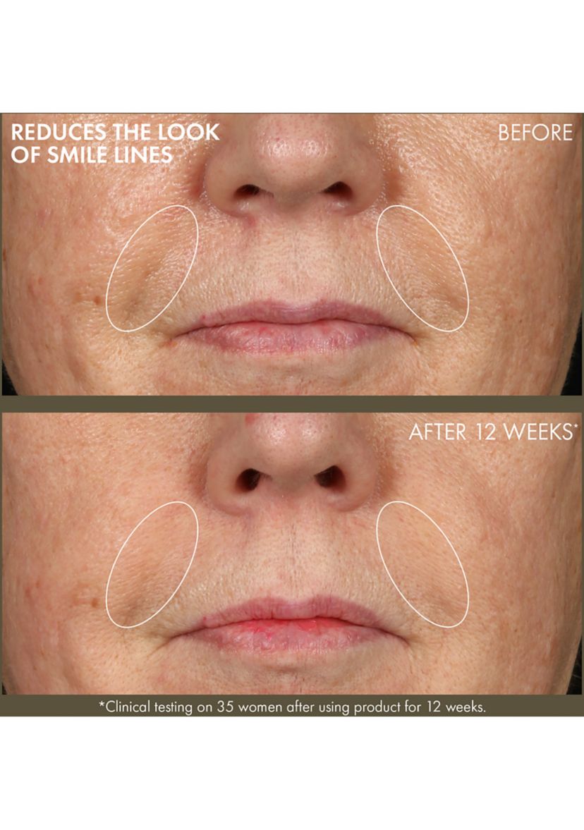 Plantscription™ Active Wrinkle Correction Serum with Retinoid