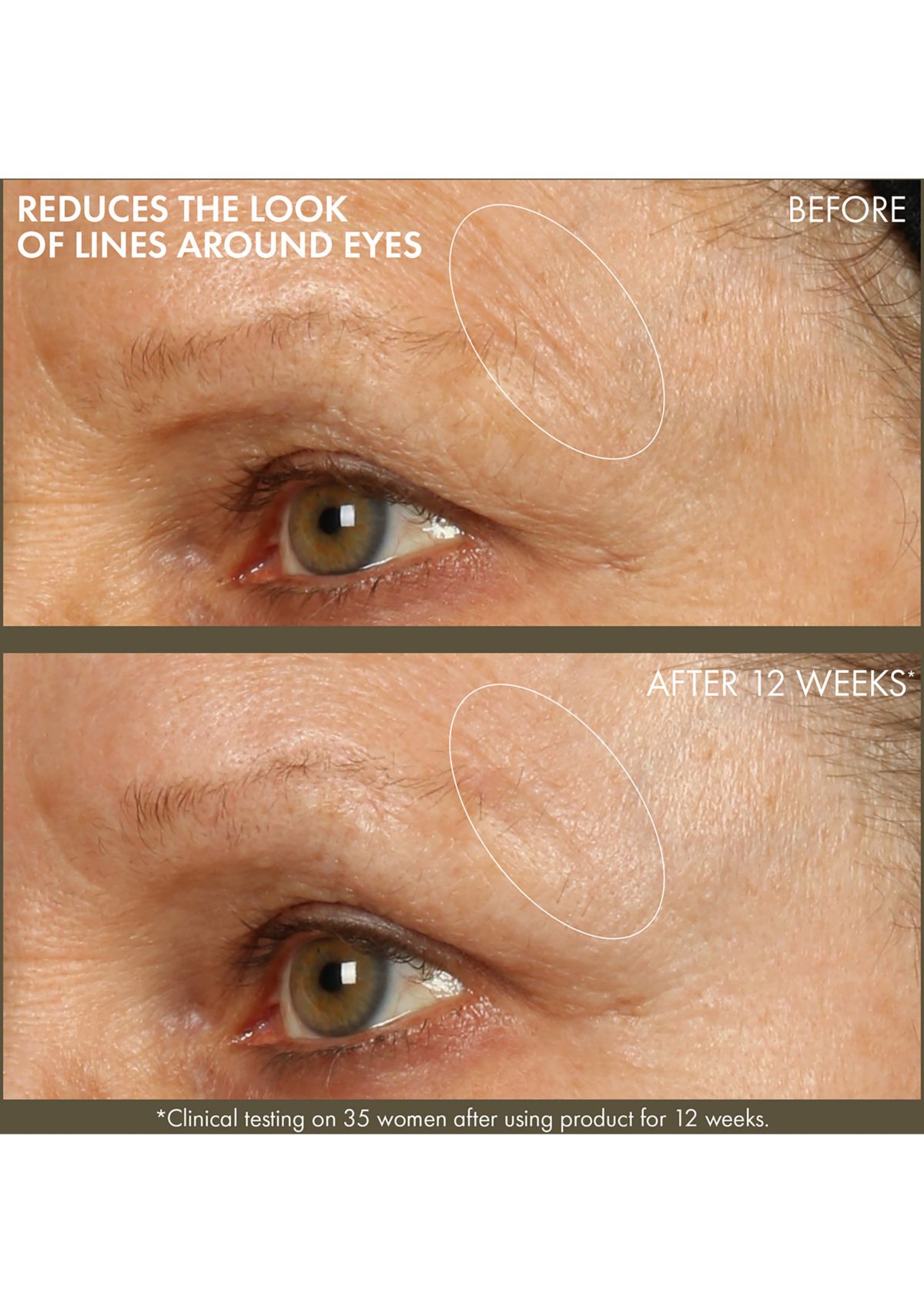 Plantscription™ Active Wrinkle Correction Serum with Retinoid