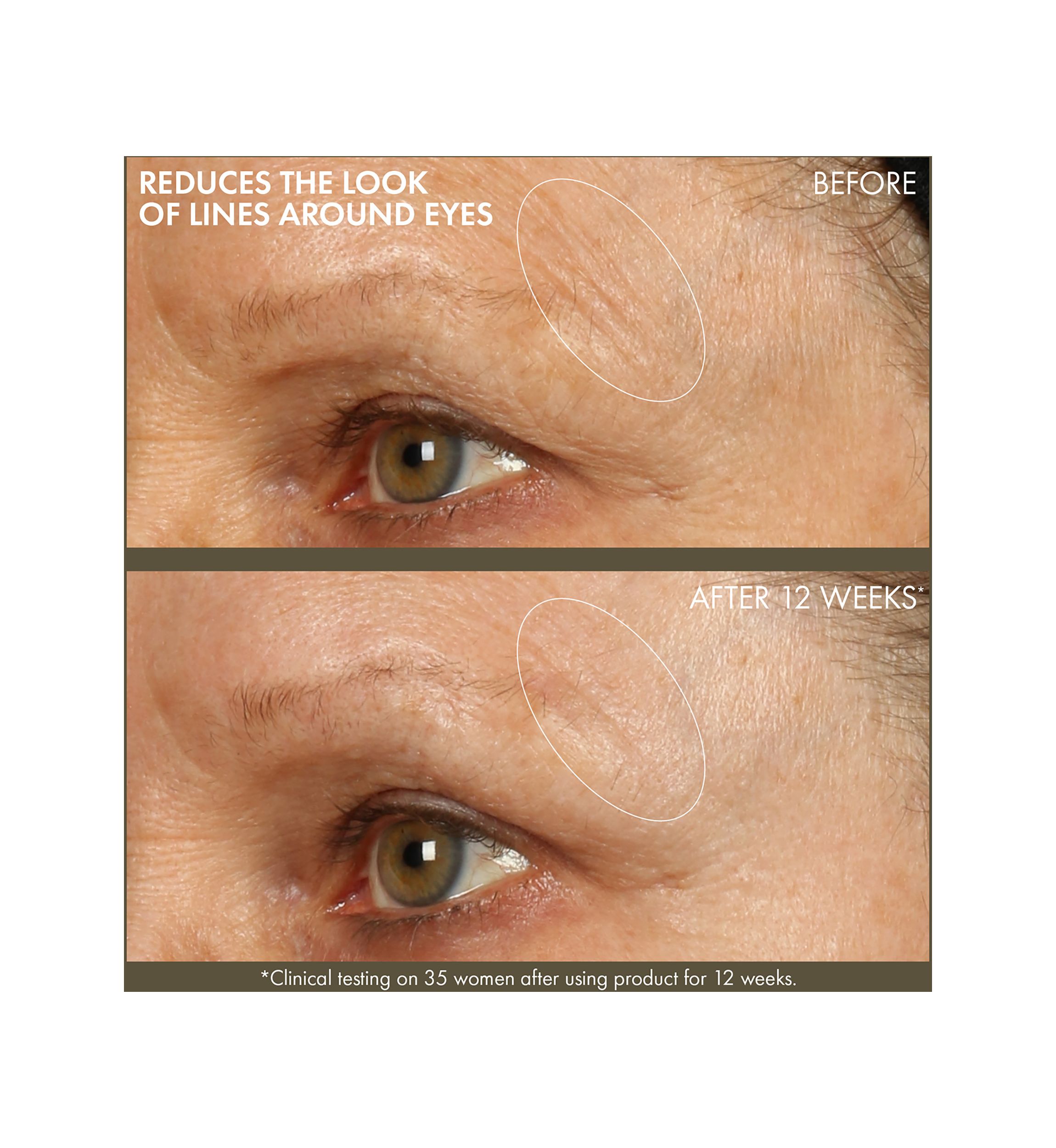 Plantscription™ Active Wrinkle Correction Serum with Retinoid
