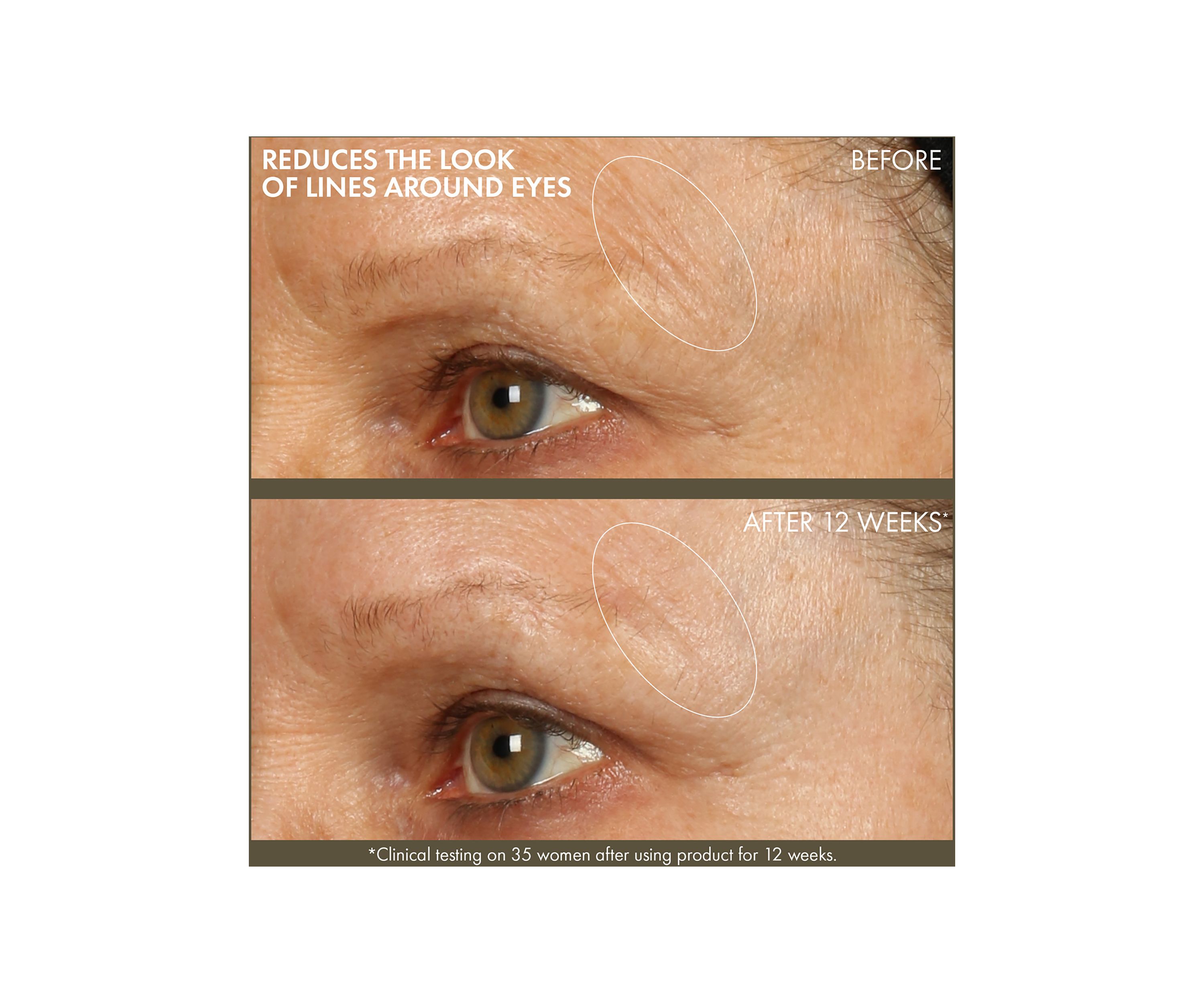 Plantscription™ Active Wrinkle Correction Serum with Retinoid