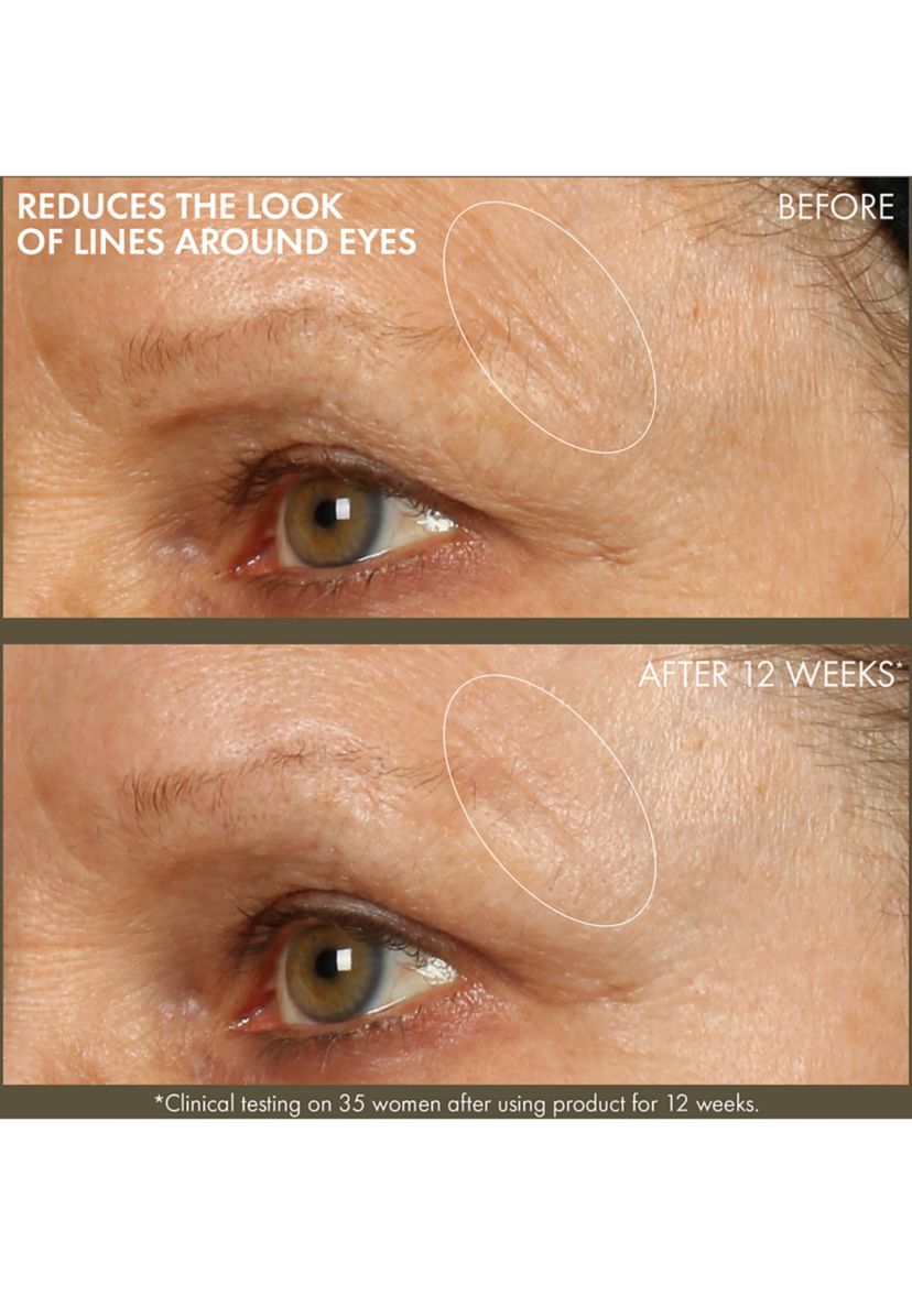 Plantscription™ Active Wrinkle Correction Serum with Retinoid