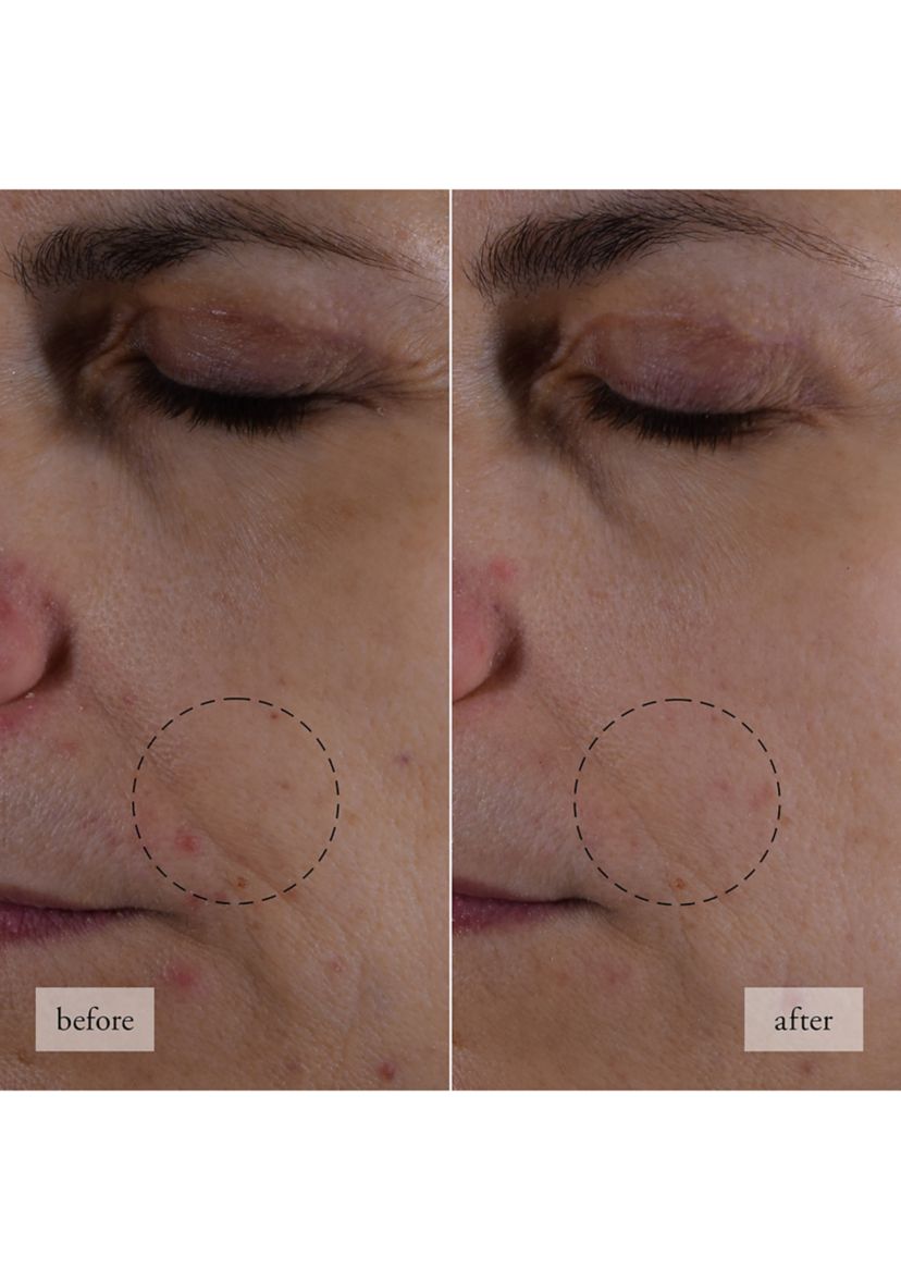 Hope in a Jar Smooth-Glow Multi-Tasking Moisturizer