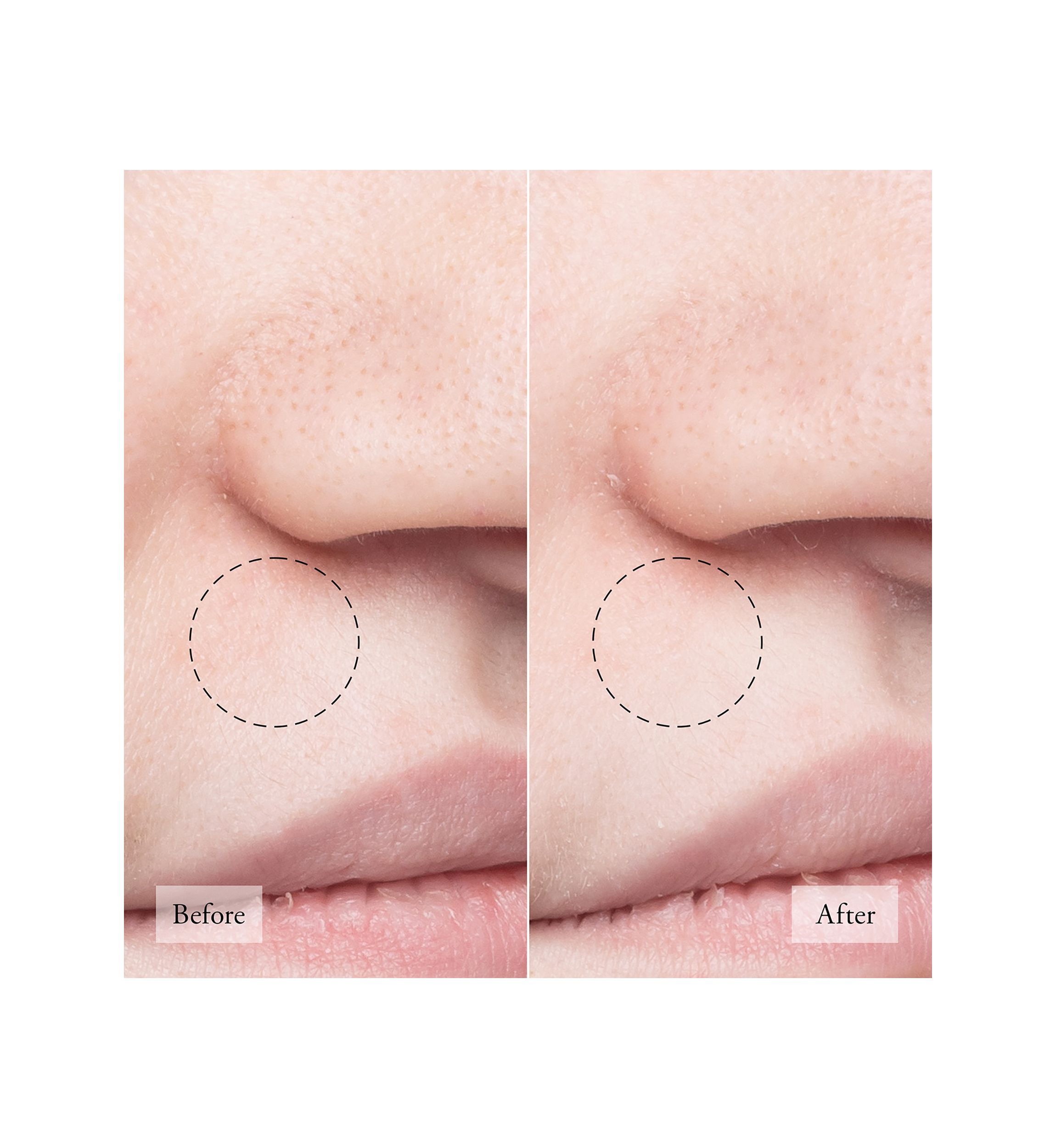 Purity Made Simple Pore Extractor Face Clay Mask