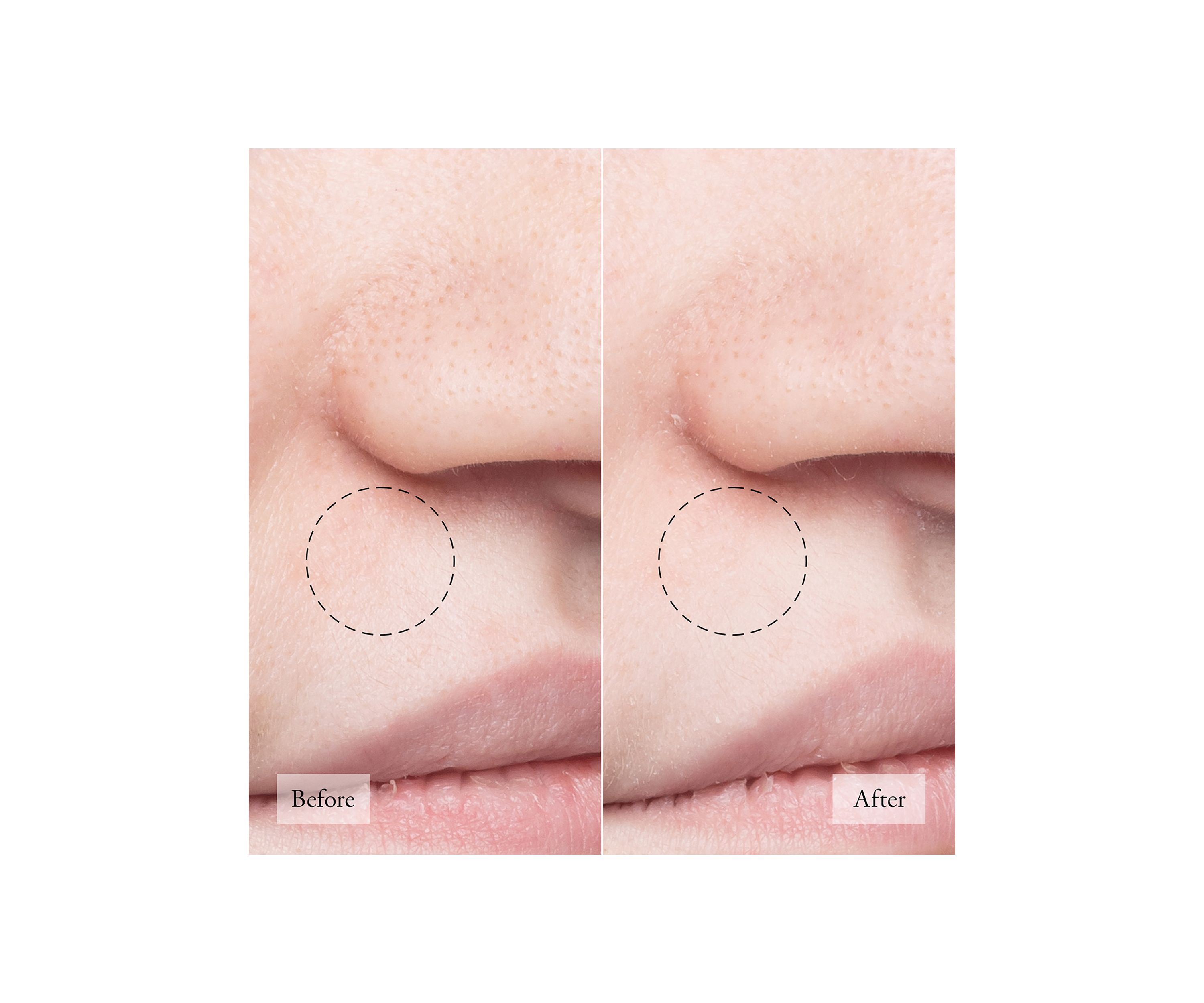 Purity Made Simple Pore Extractor Face Clay Mask