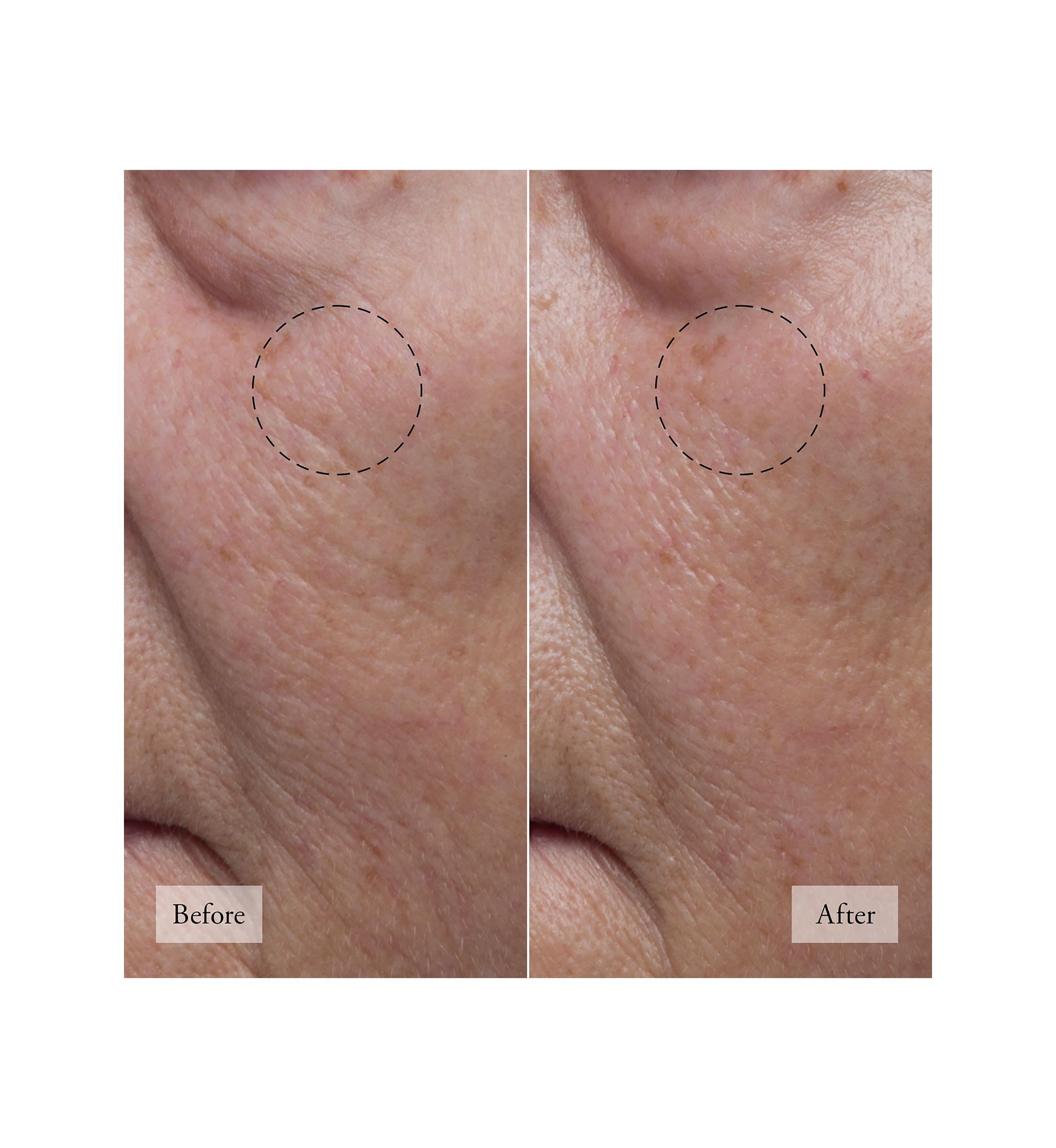 Hope in a Jar Hyaluronic Glow Moisturizer