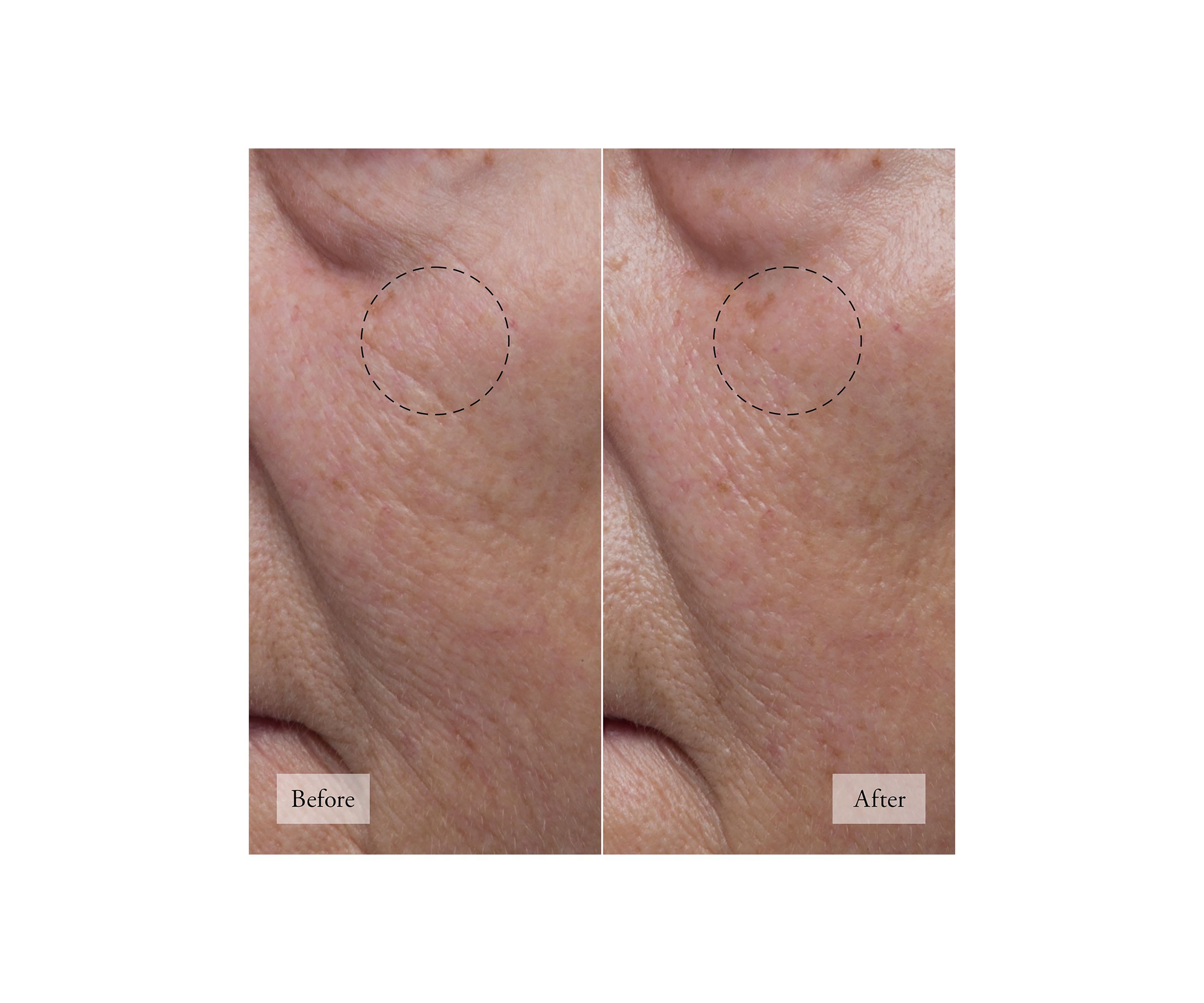 Hope in a Jar Hyaluronic Glow Moisturizer