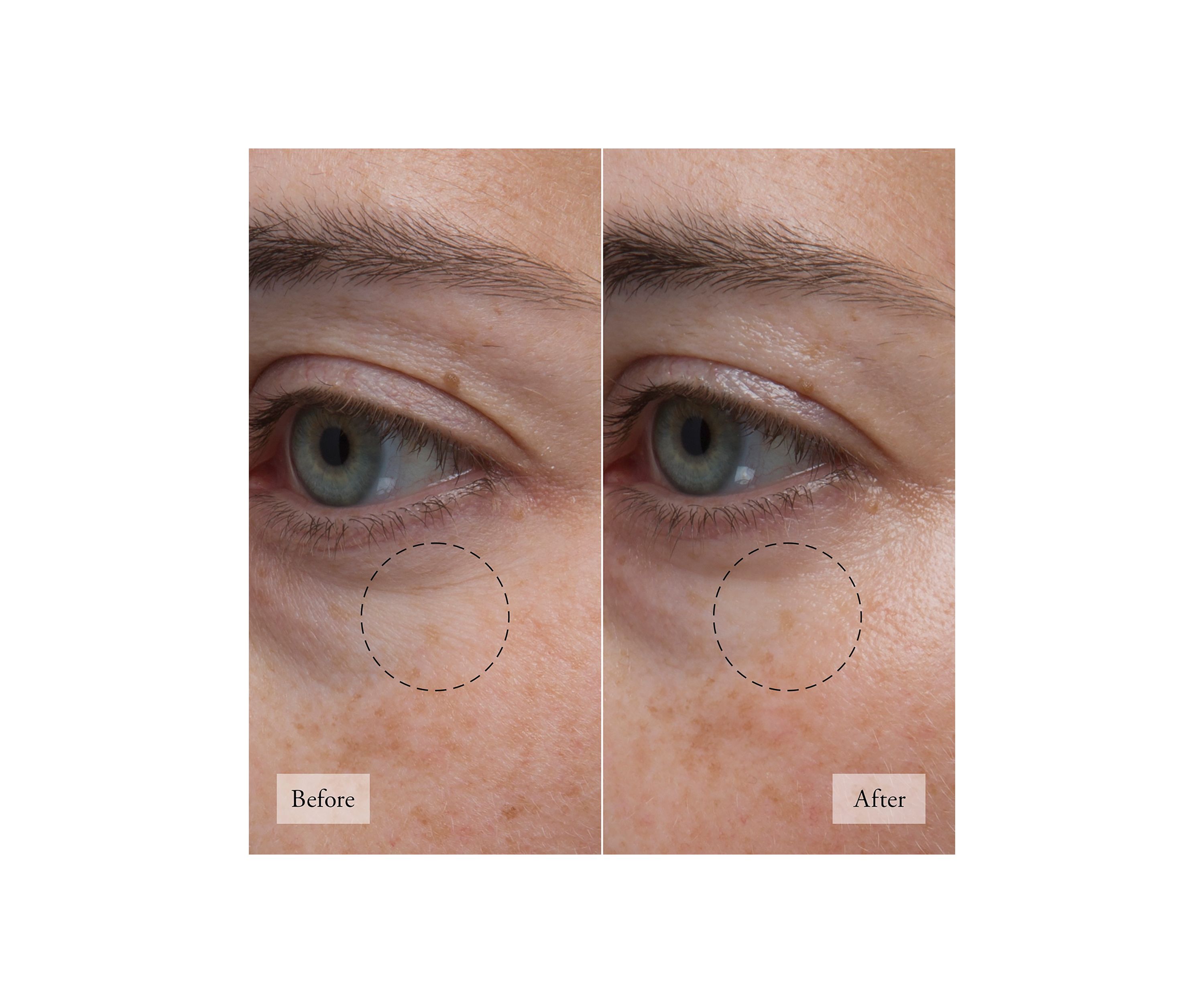 Hope in a Jar Eye Revival Serum-in-Cream