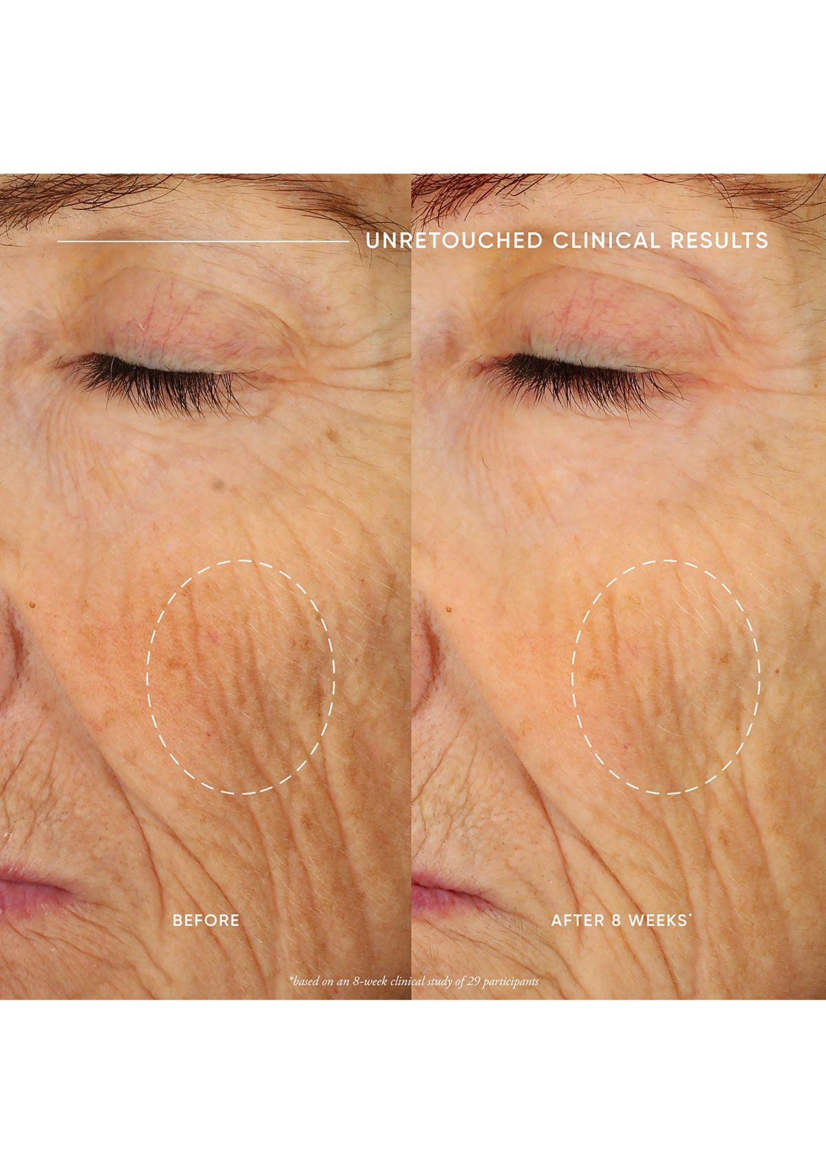 Ultimate Miracle Worker Nourish & Rejuvenate Face & Neck Cream