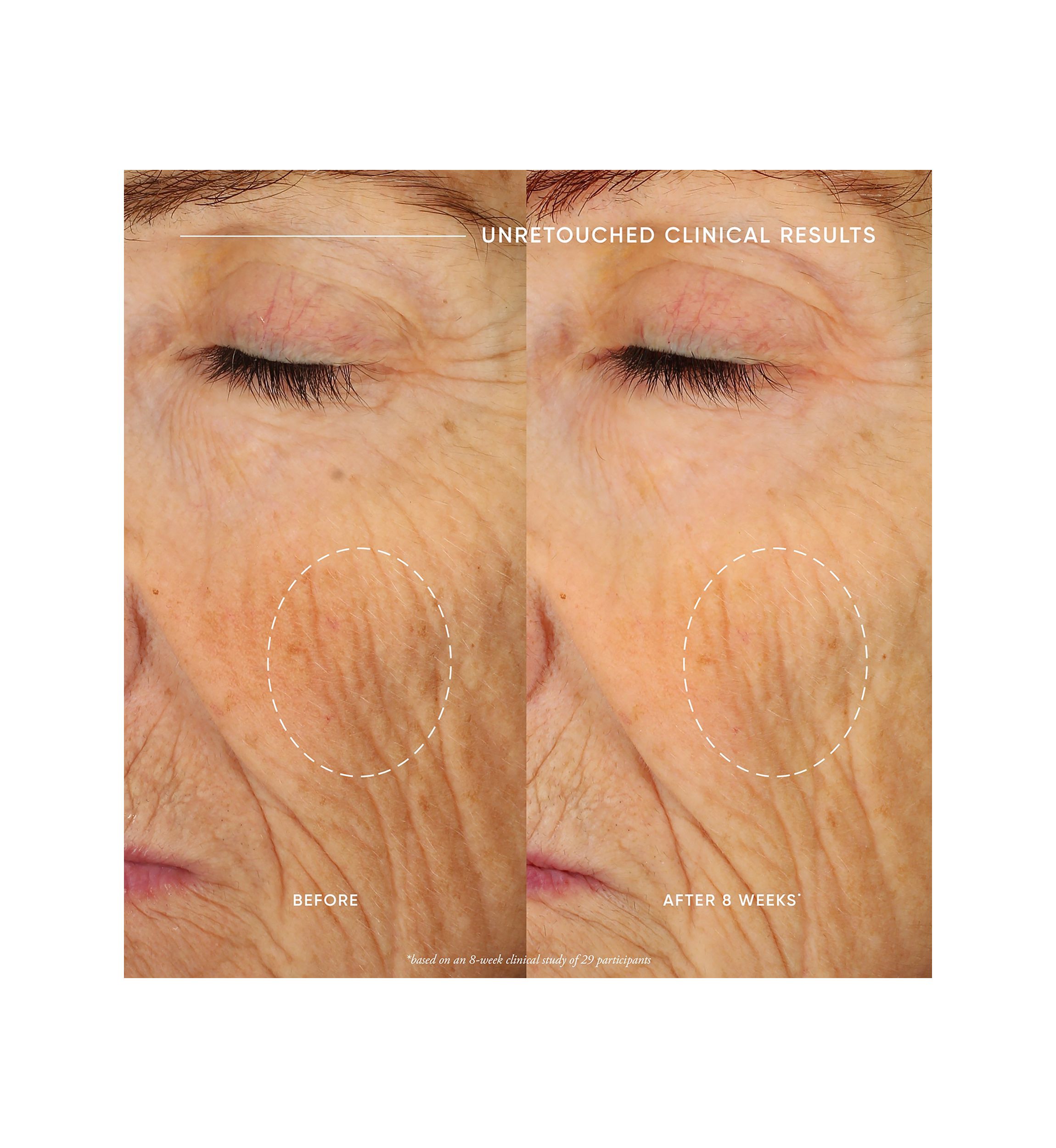 Ultimate Miracle Worker Nourish & Rejuvenate Face & Neck Cream