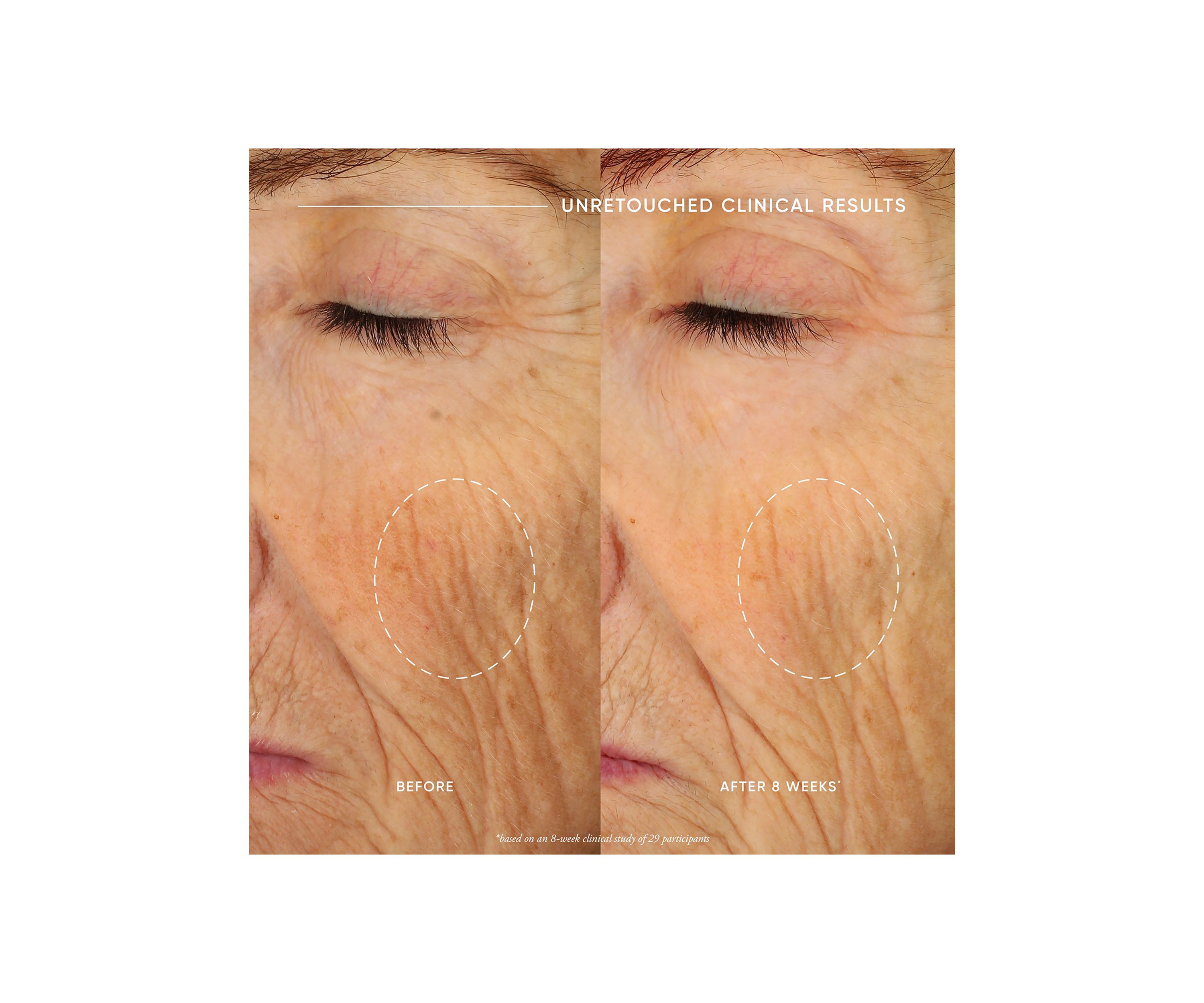 Ultimate Miracle Worker Nourish & Rejuvenate Face & Neck Cream