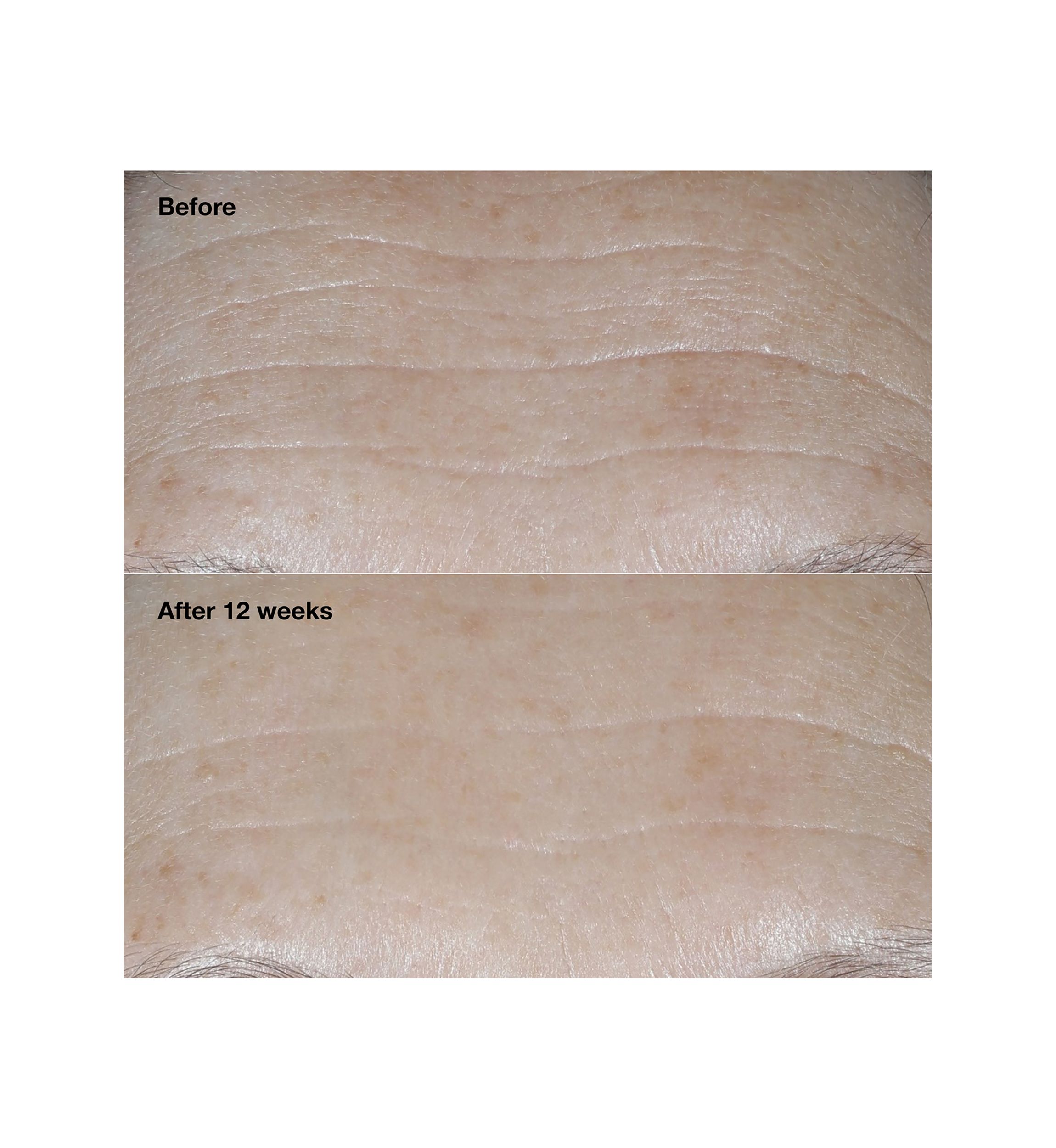 Smart Clinical Repair™ Broad Spectrum SPF 30 Wrinkle Correcting Face Cream