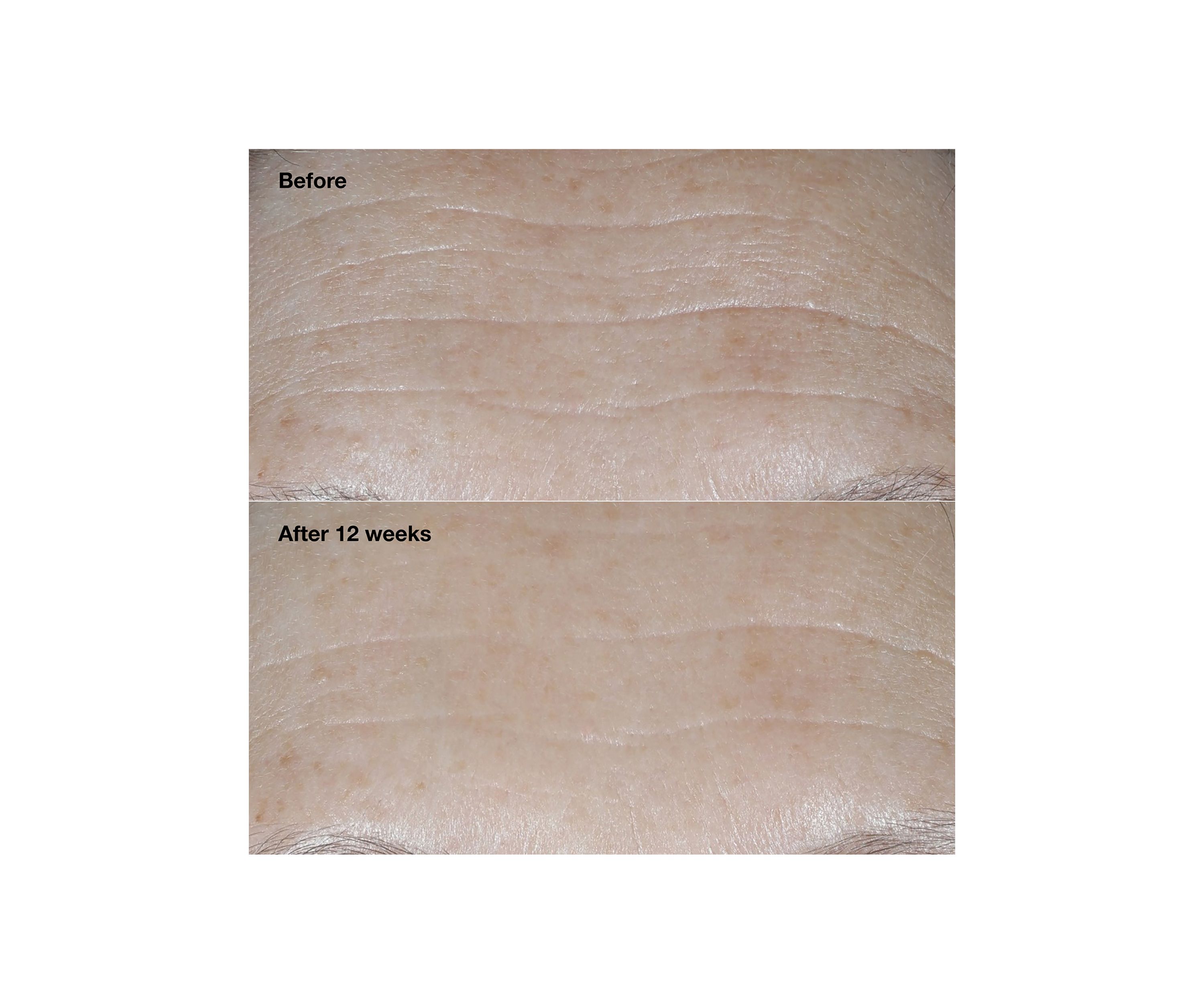 Smart Clinical Repair™ Broad Spectrum SPF 30 Wrinkle Correcting Face Cream