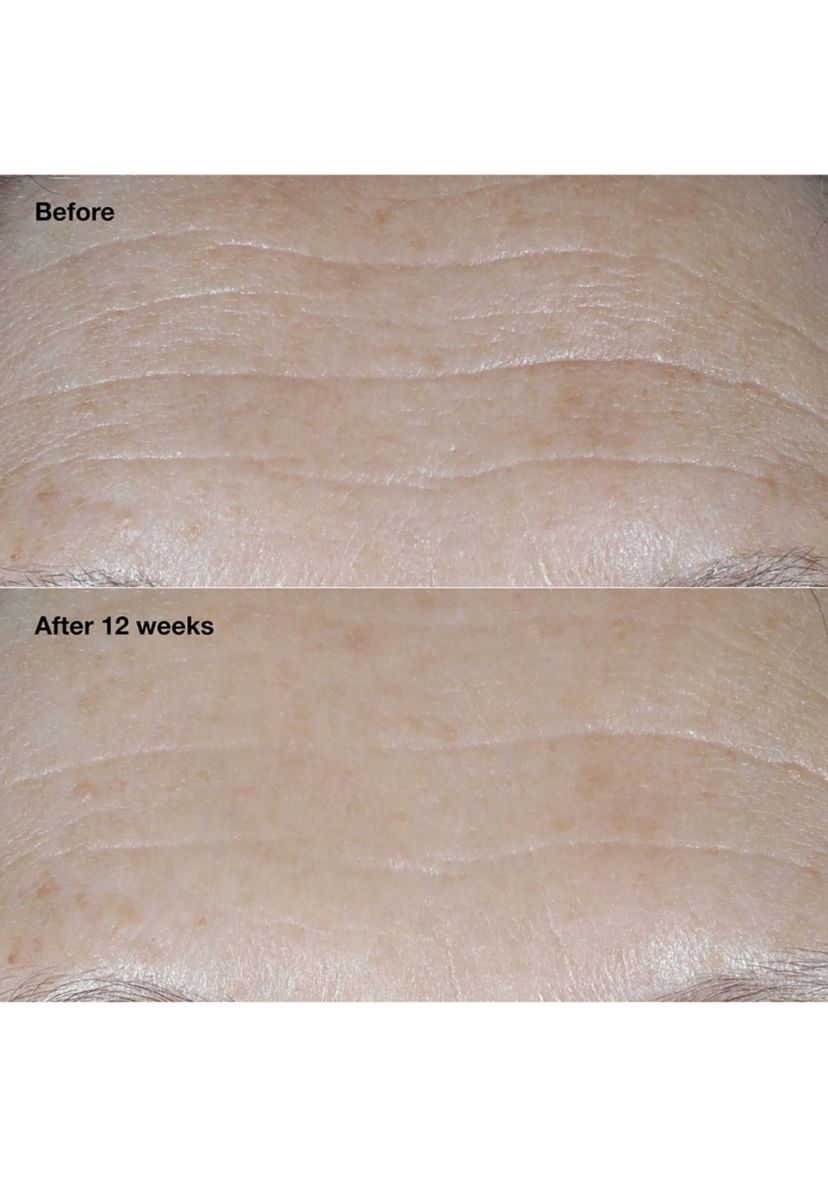 Smart Clinical Repair™ Broad Spectrum SPF 30 Wrinkle Correcting Face Cream