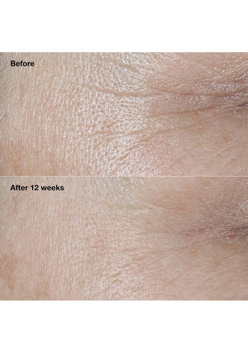 Smart Clinical Repair™ Broad Spectrum SPF 30 Wrinkle Correcting Face Cream