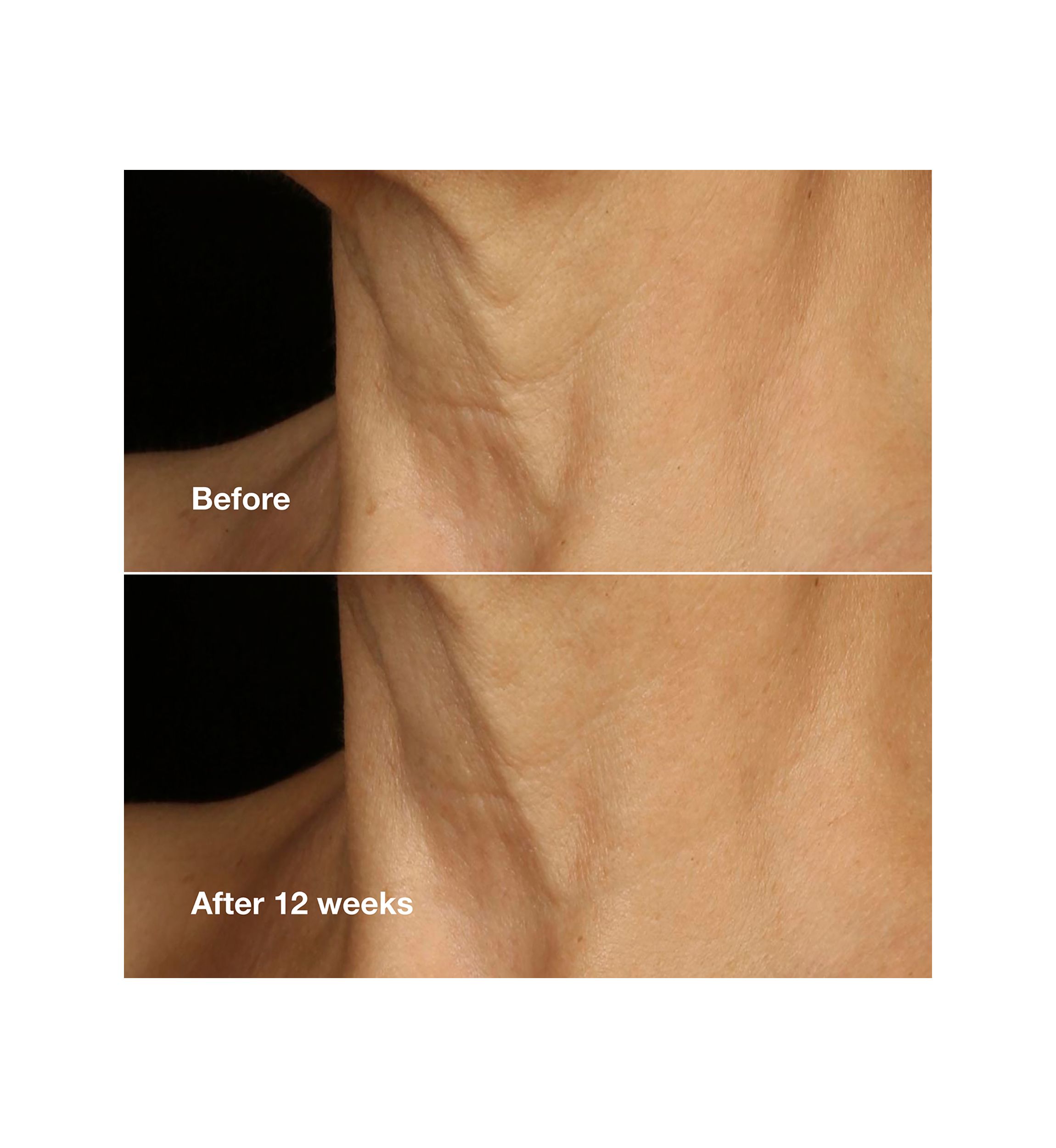 Smart Clinical Repair™ Lifting Face + Neck Cream