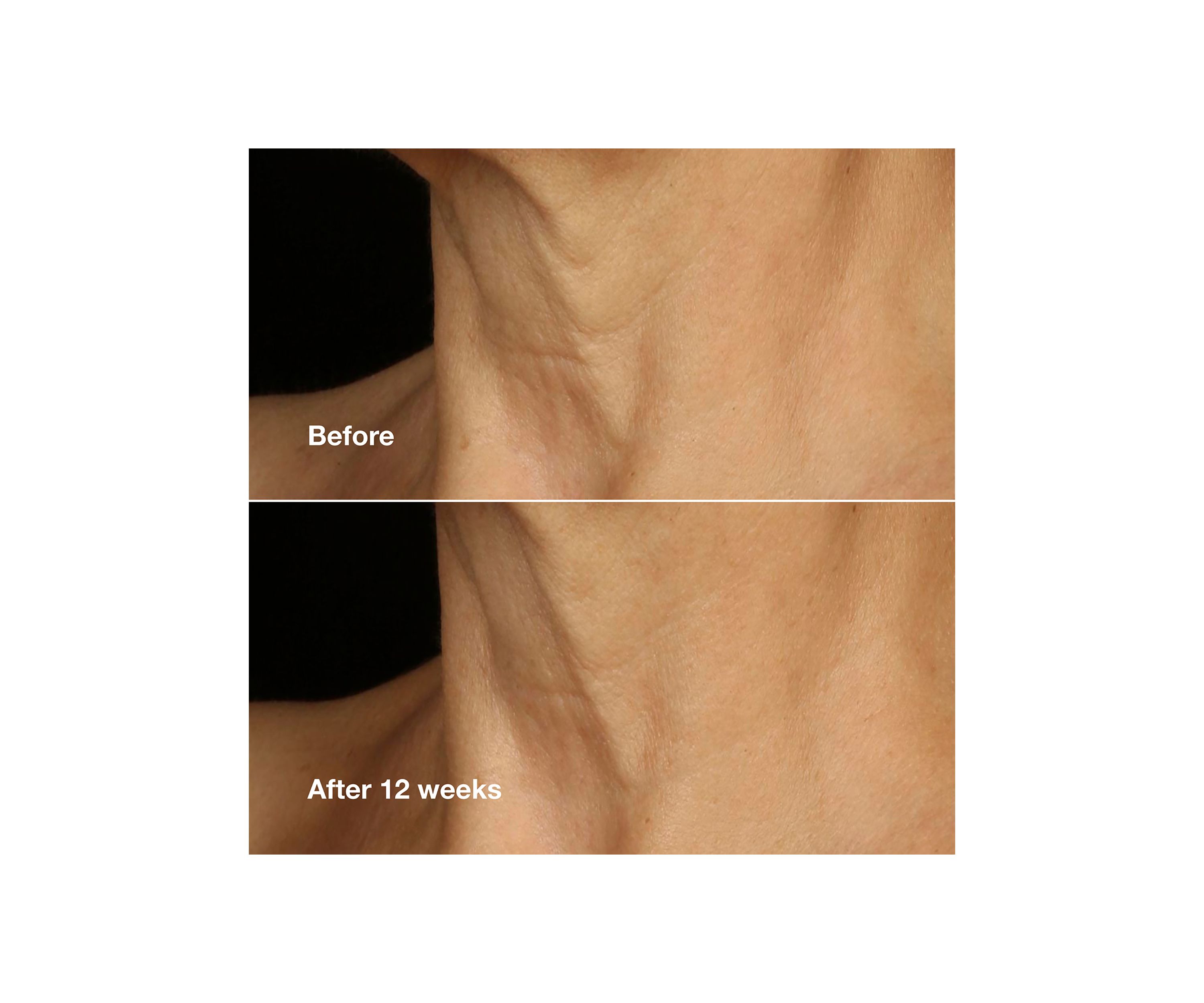 Smart Clinical Repair™ Lifting Face + Neck Cream