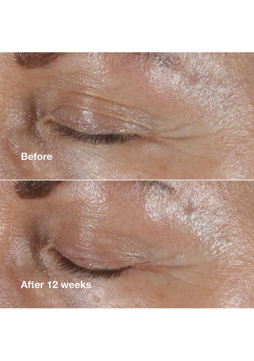 Smart Clinical Repair™ Wrinkle Correcting Eye Cream