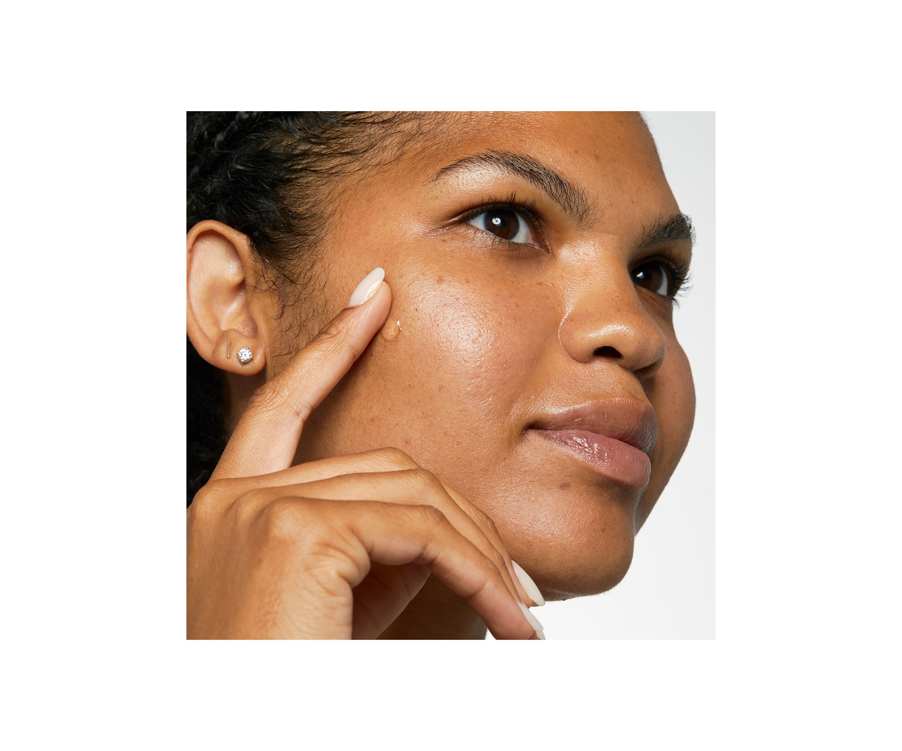 Acne Solutions™ Clinical Clearing Gel 