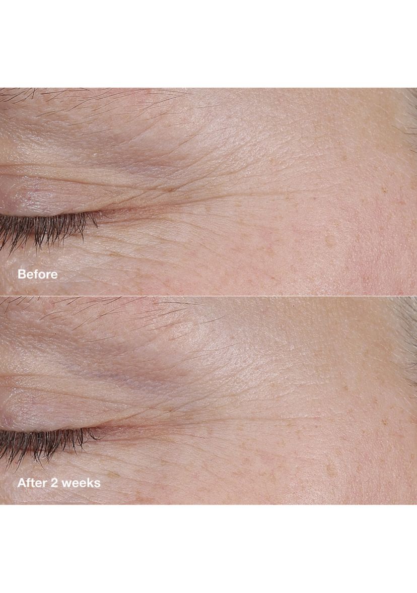Smart Clinical Repair™ AM/PM Retinoid Balm 