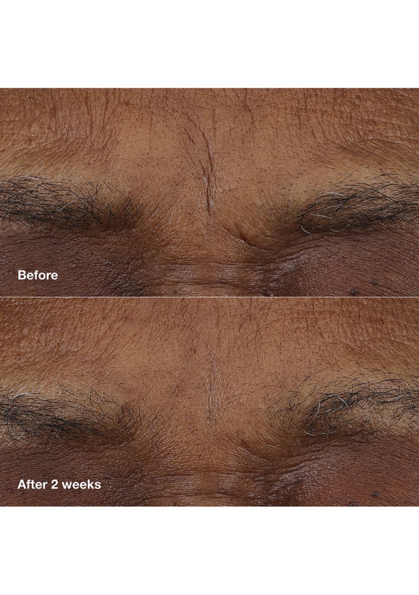 Smart Clinical Repair™ AM/PM Retinoid Balm 