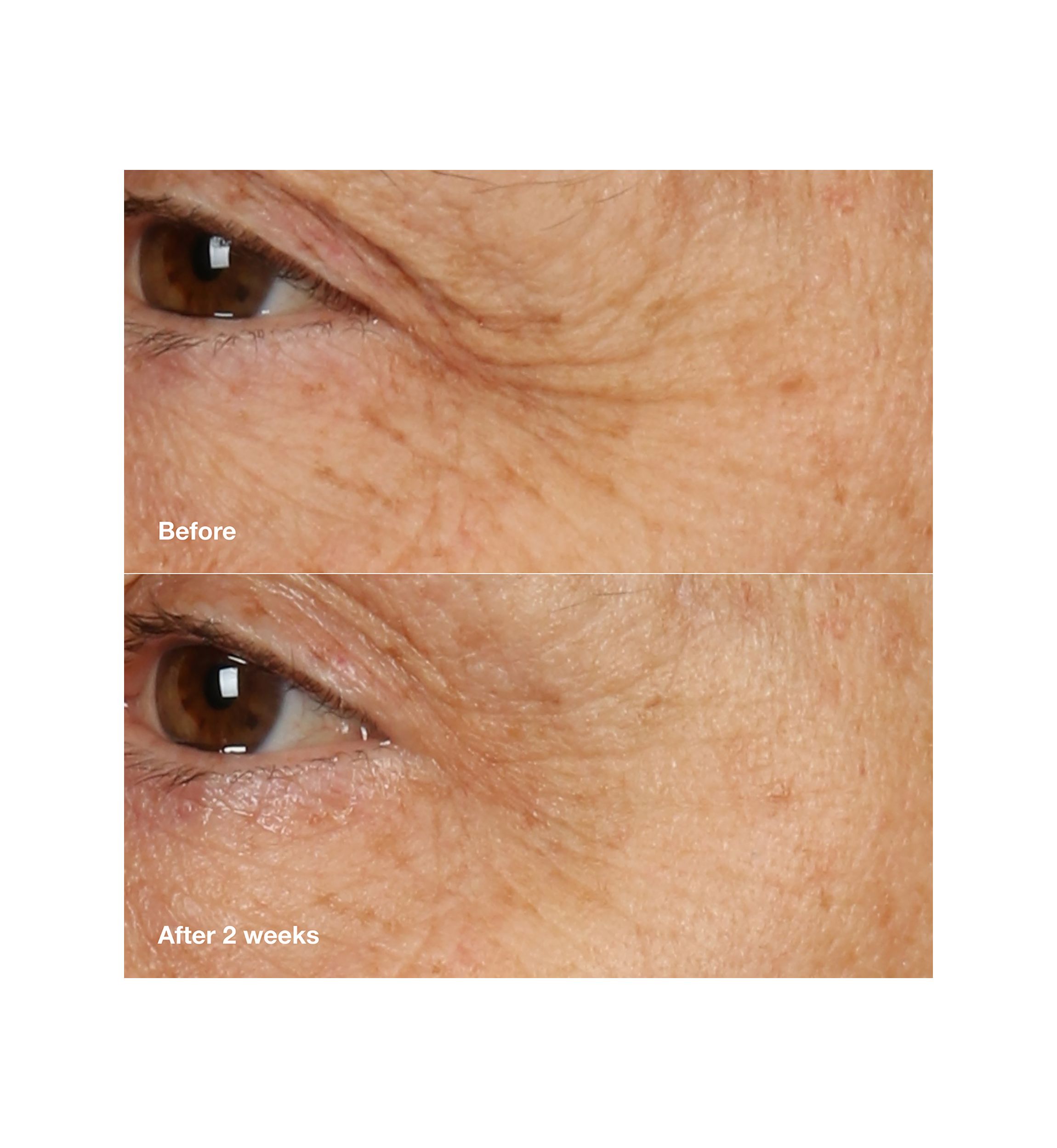 Smart Clinical Repair™ Overnight Recovery Face Cream + Mask