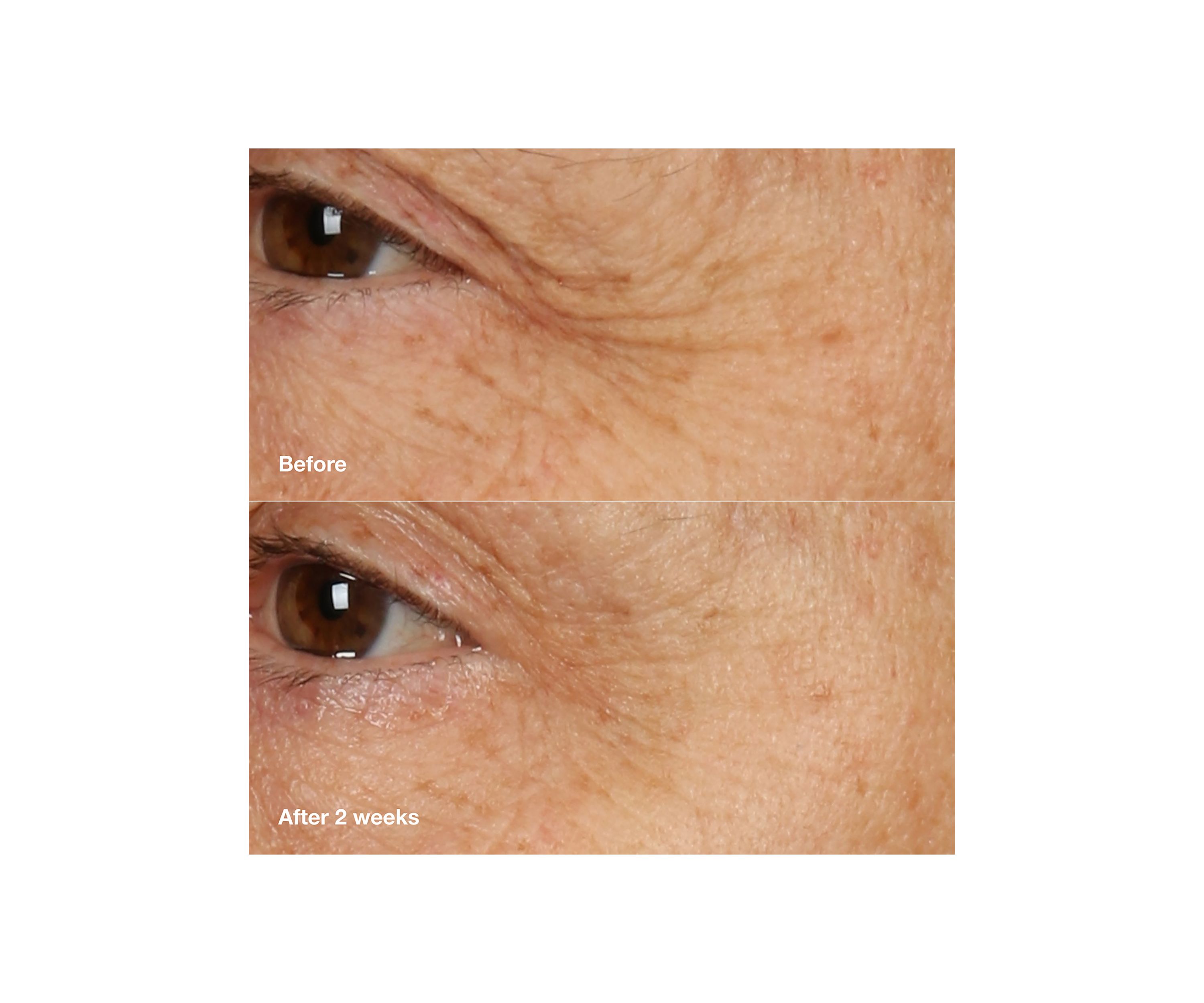 Smart Clinical Repair™ Overnight Recovery Face Cream + Mask