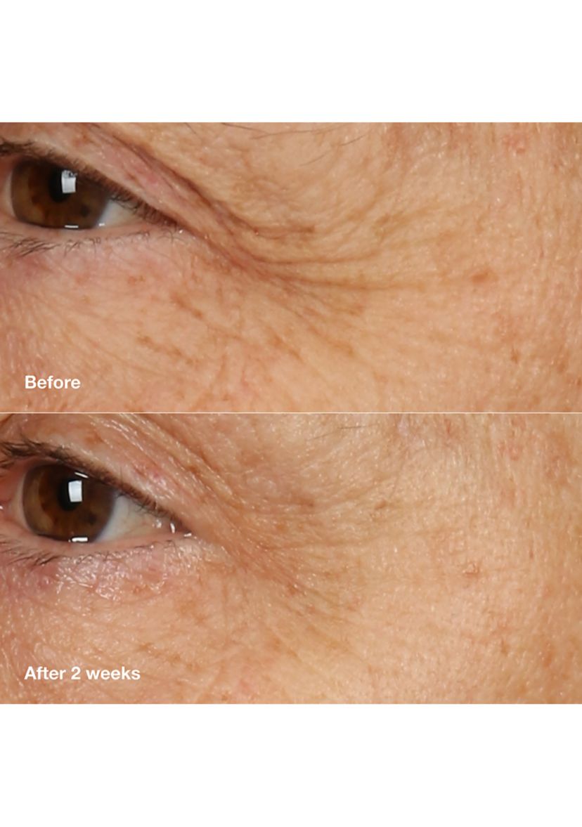 Smart Clinical Repair™ Overnight Recovery Face Cream + Mask