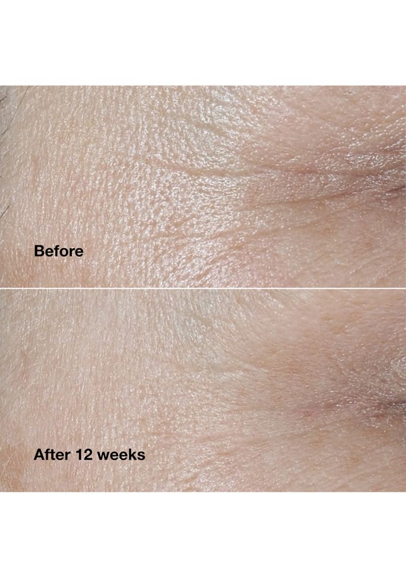 Smart Clinical Repair™ Wrinkle Correcting Face Cream