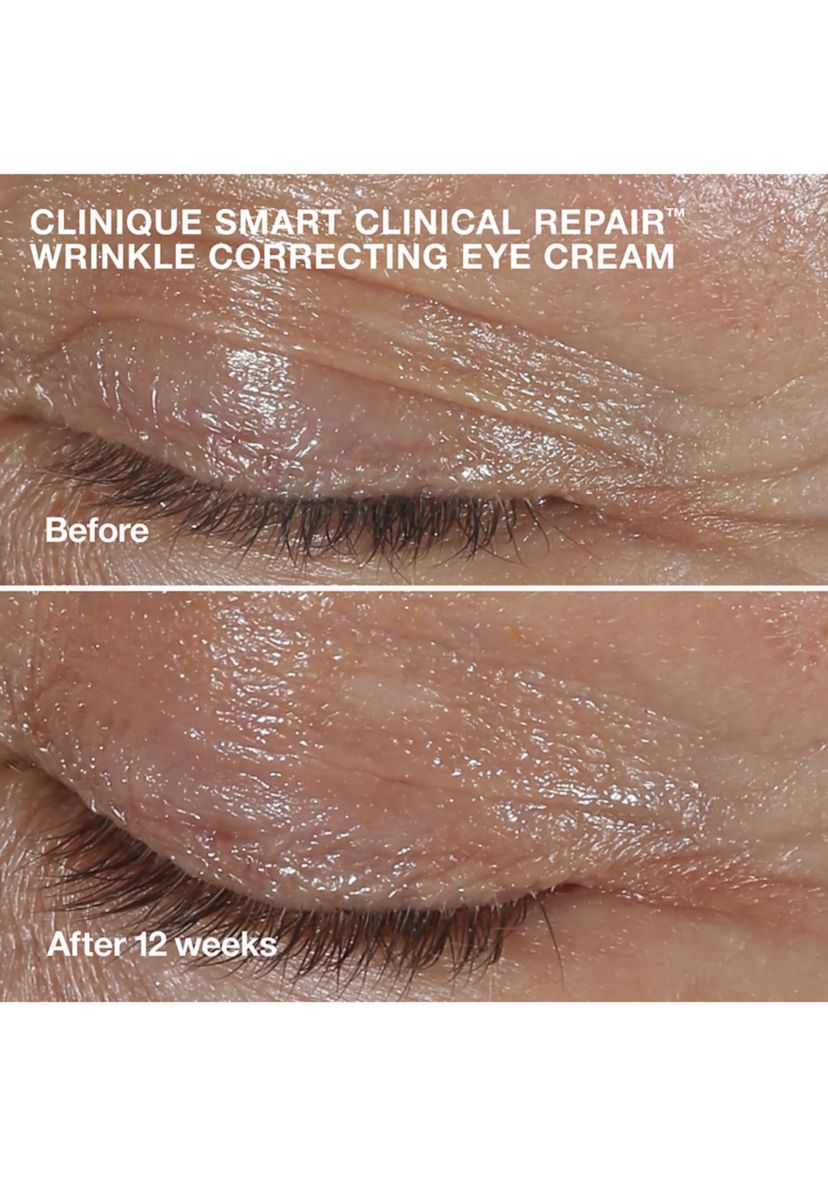 Wrinkle Fighting Routine Skincare Gift Set - $129 Value!