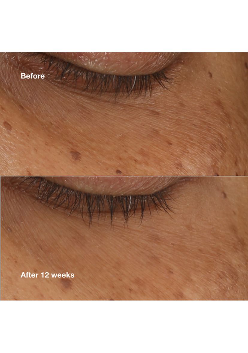 All About Eyes Brightening Serum Concentrate 