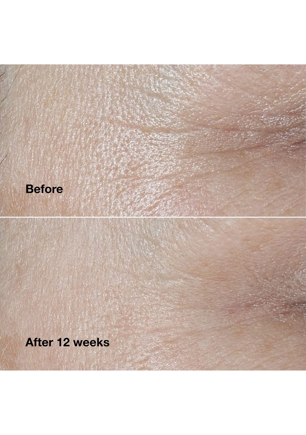 Smart Clinical Repair™ Wrinkle Correcting Face Cream