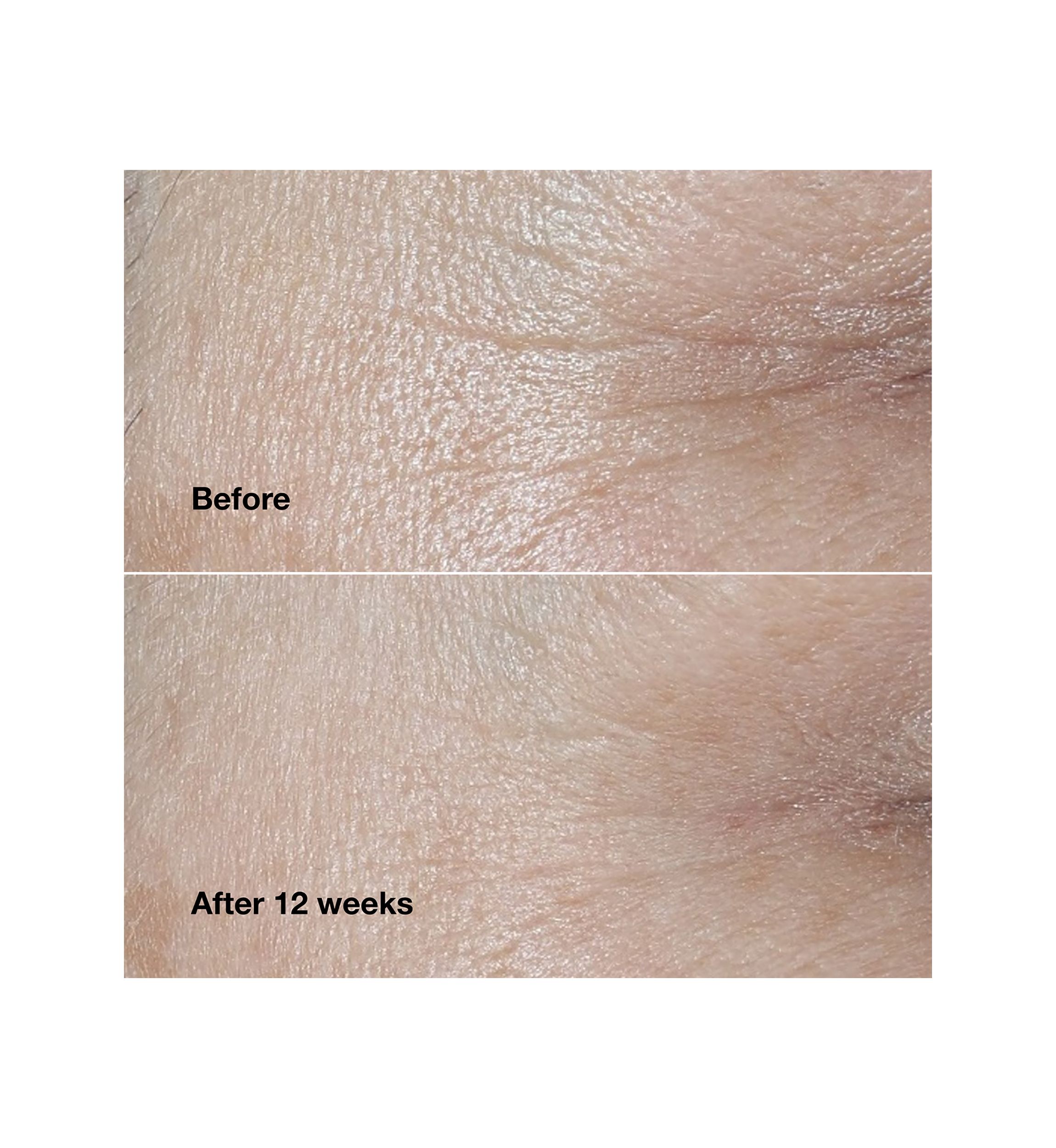 Smart Clinical Repair™ Wrinkle Correcting Face Cream