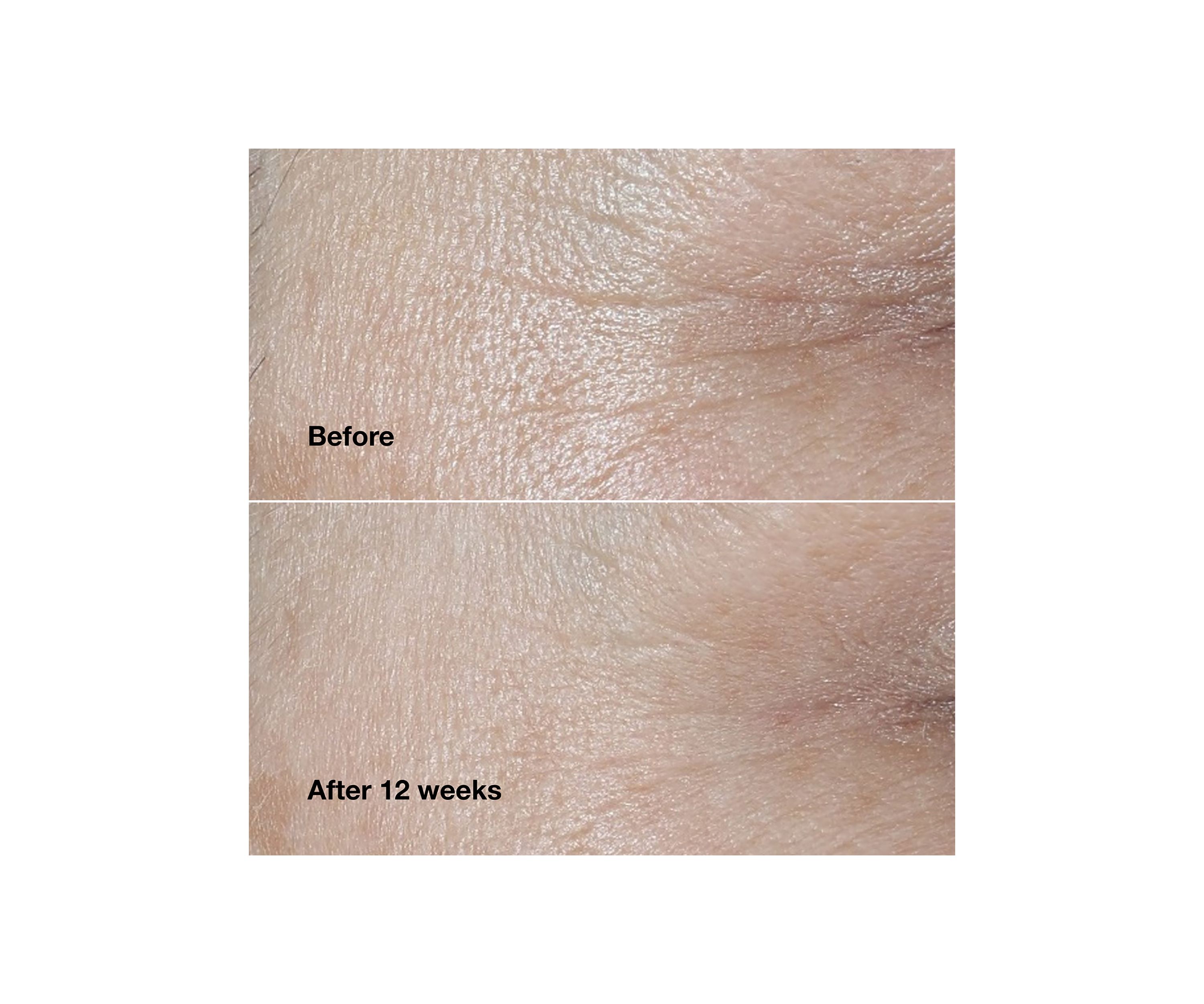 Smart Clinical Repair™ Wrinkle Correcting Face Cream