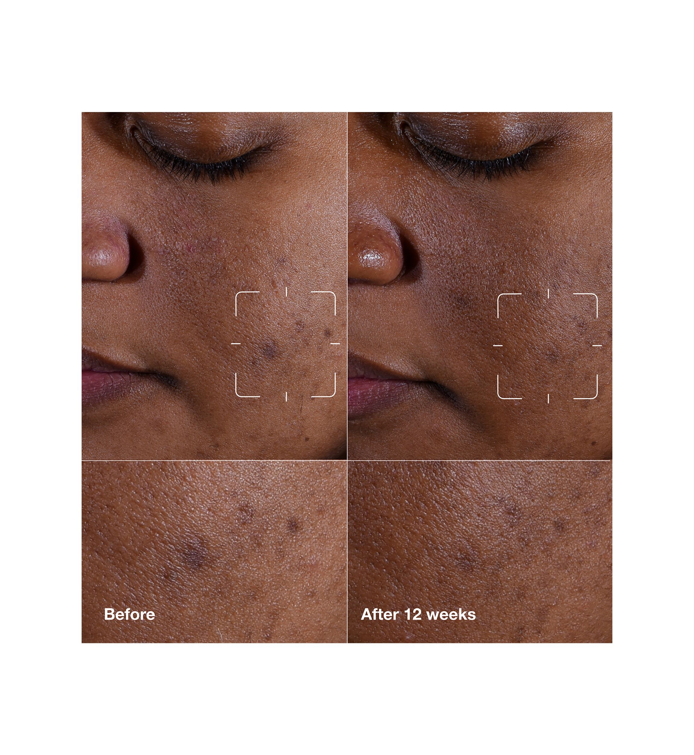 Even Better Clinical™ Dark Spot Clearing Serum with Vitamin C 