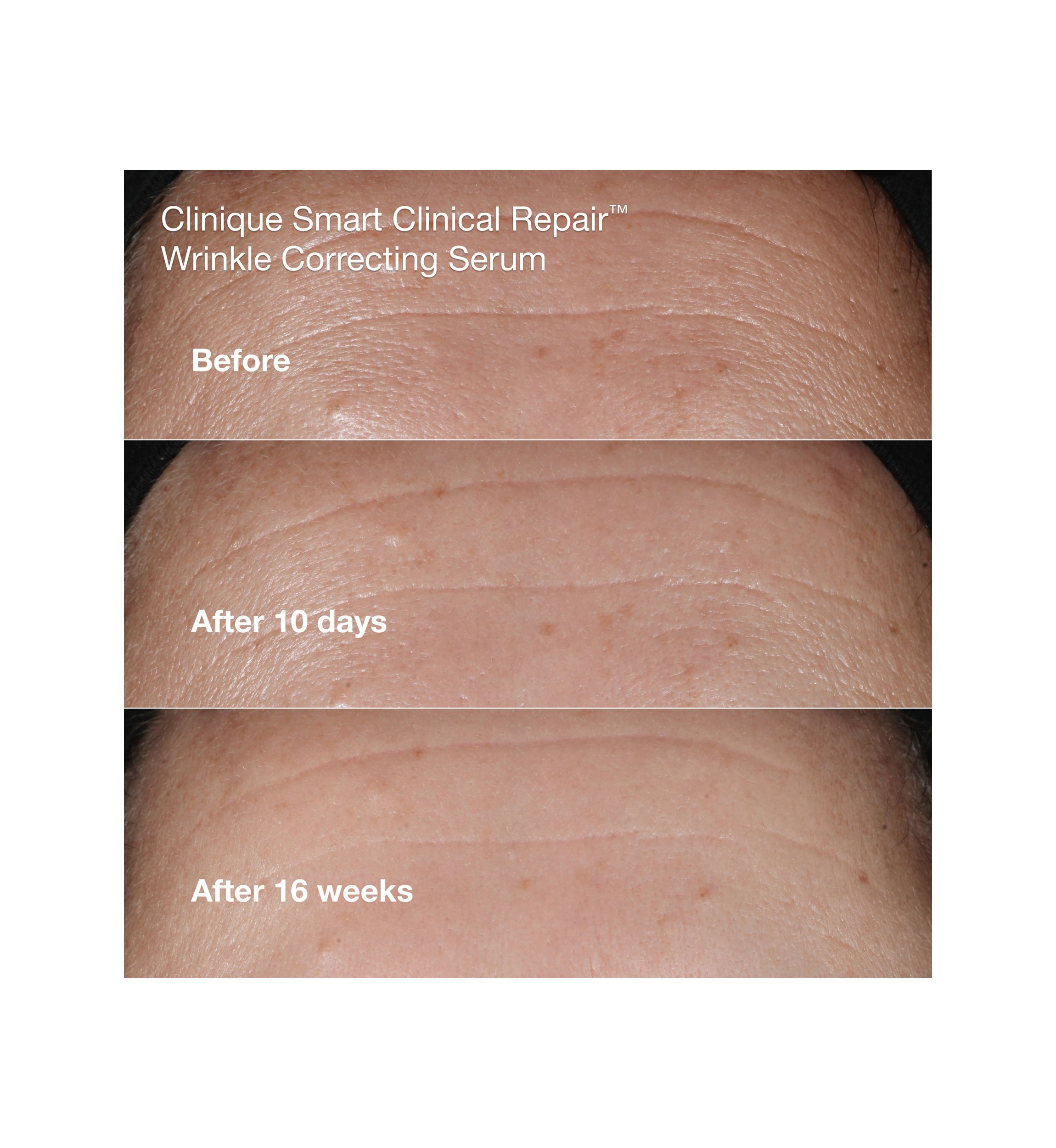 Wrinkle Fighting Routine Anti-Aging Skincare Gift Set - $129 Value!