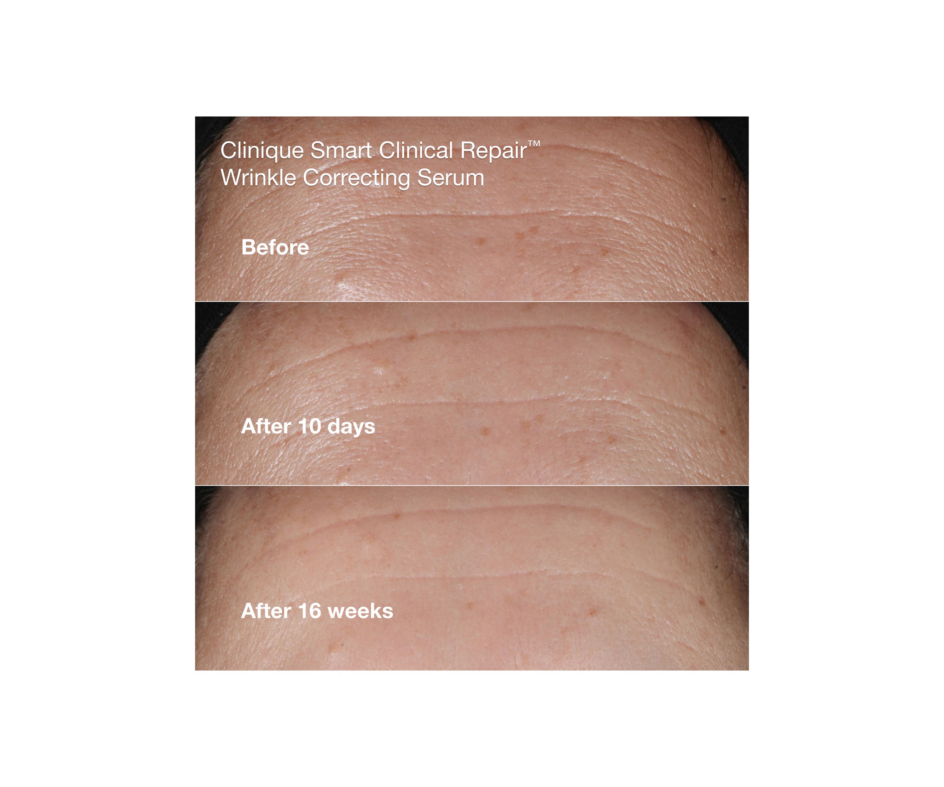 Wrinkle Fighting Routine Anti-Aging Skincare Gift Set - $129 Value!