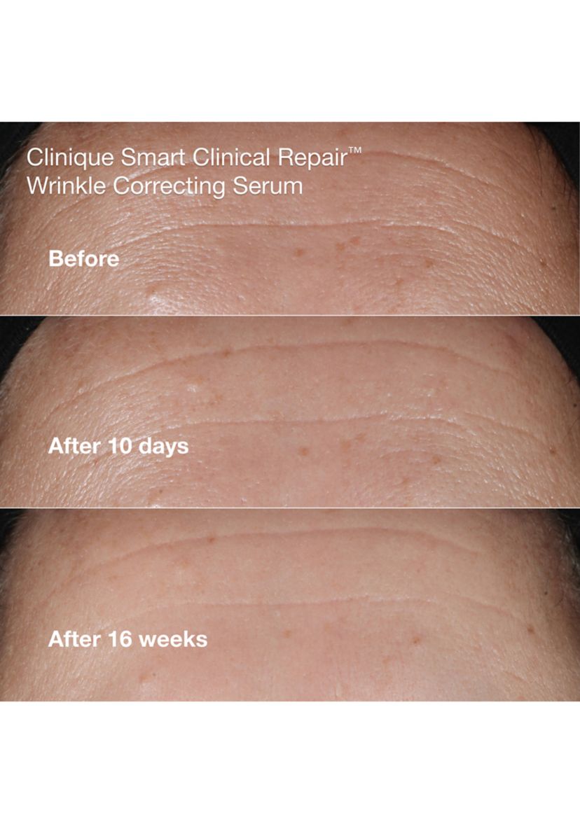 Wrinkle Fighting Routine Anti-Aging Skincare Gift Set - $129 Value!