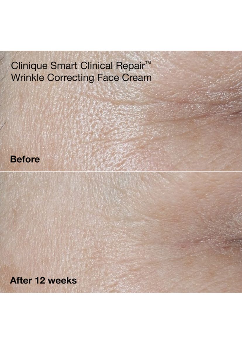 Wrinkle Fighting Routine Anti-Aging Skincare Gift Set - $129 Value!