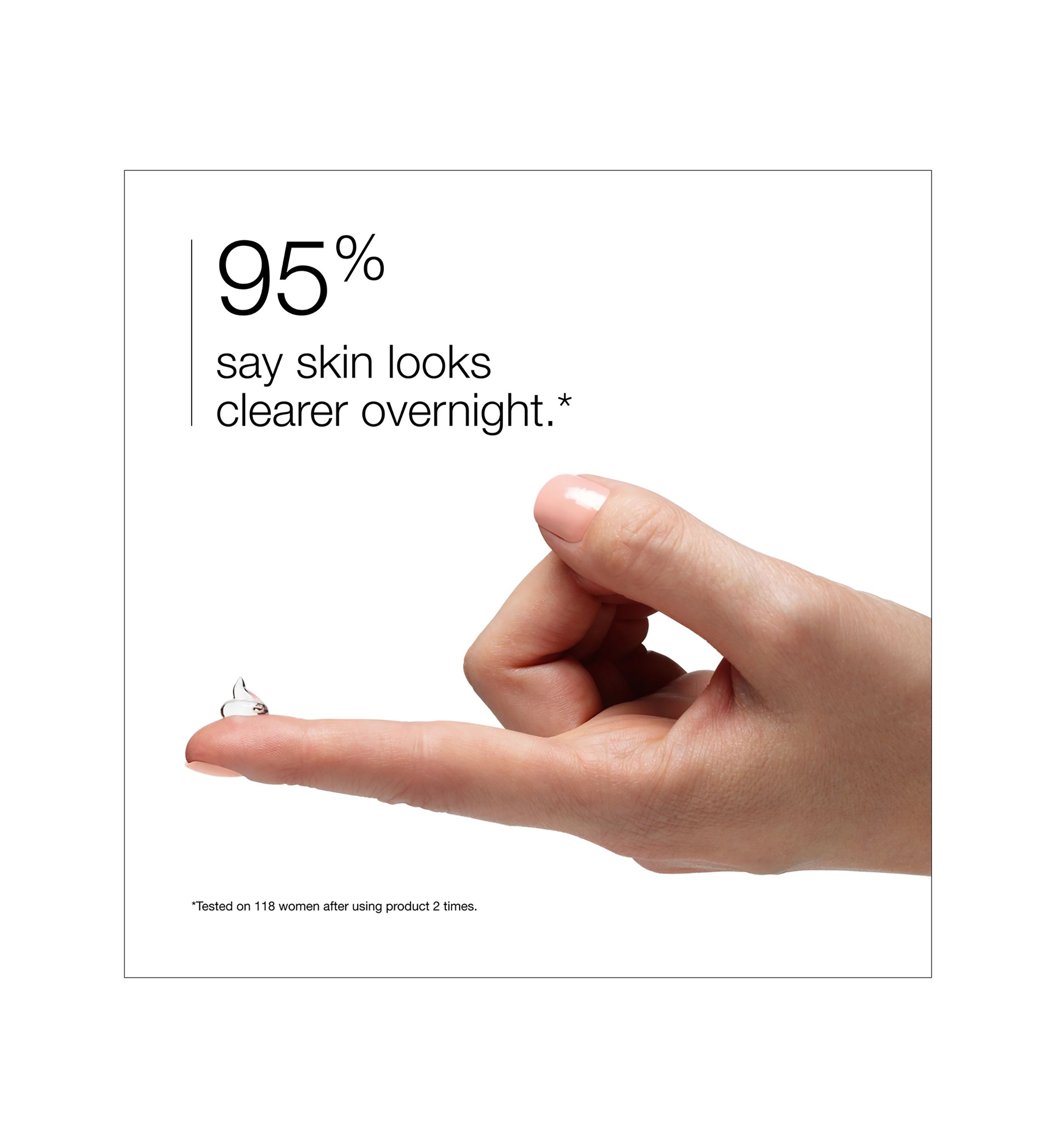 Acne Solutions™ Clinical Clearing Gel 