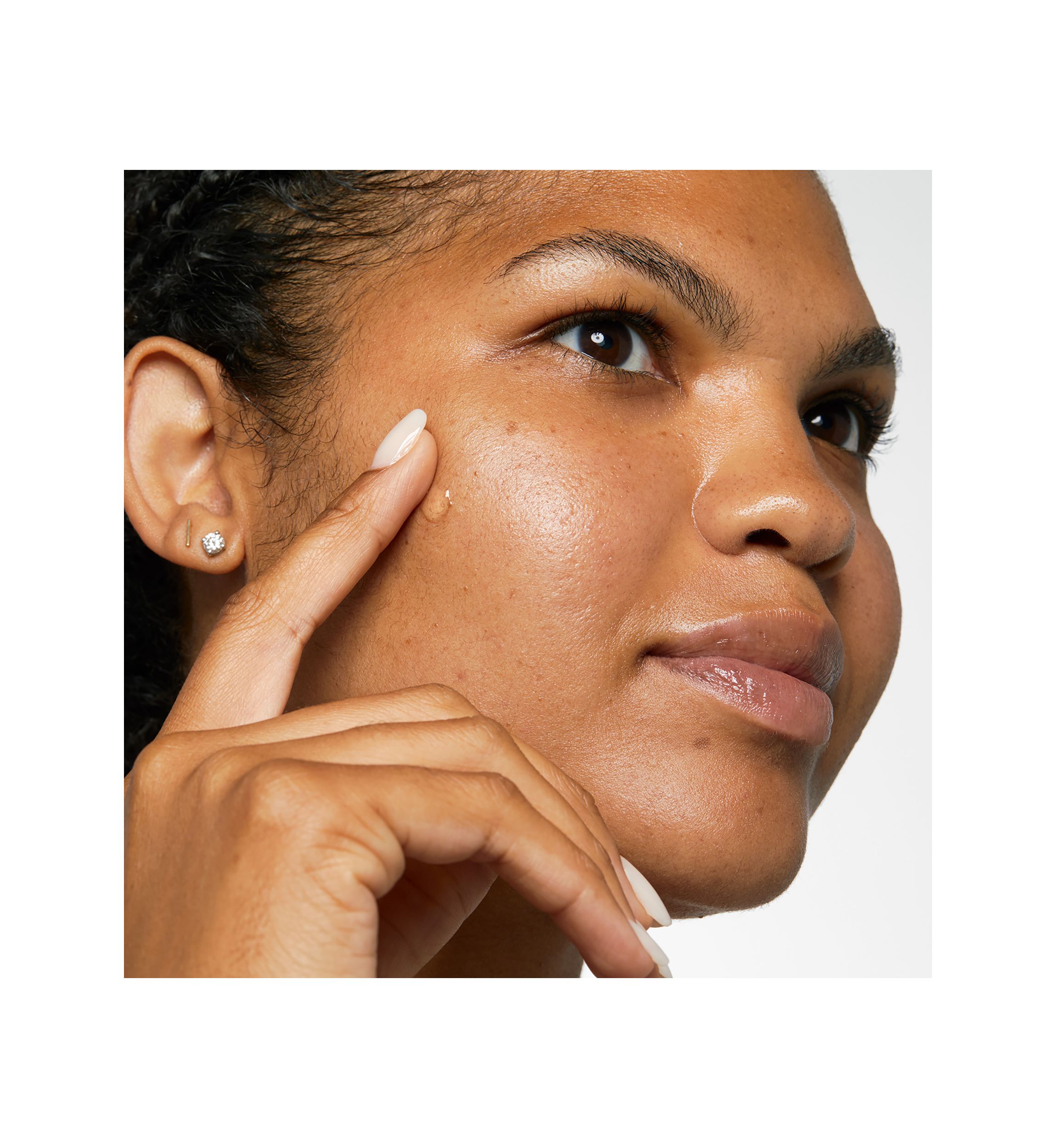 Acne Solutions™ Clinical Clearing Gel 