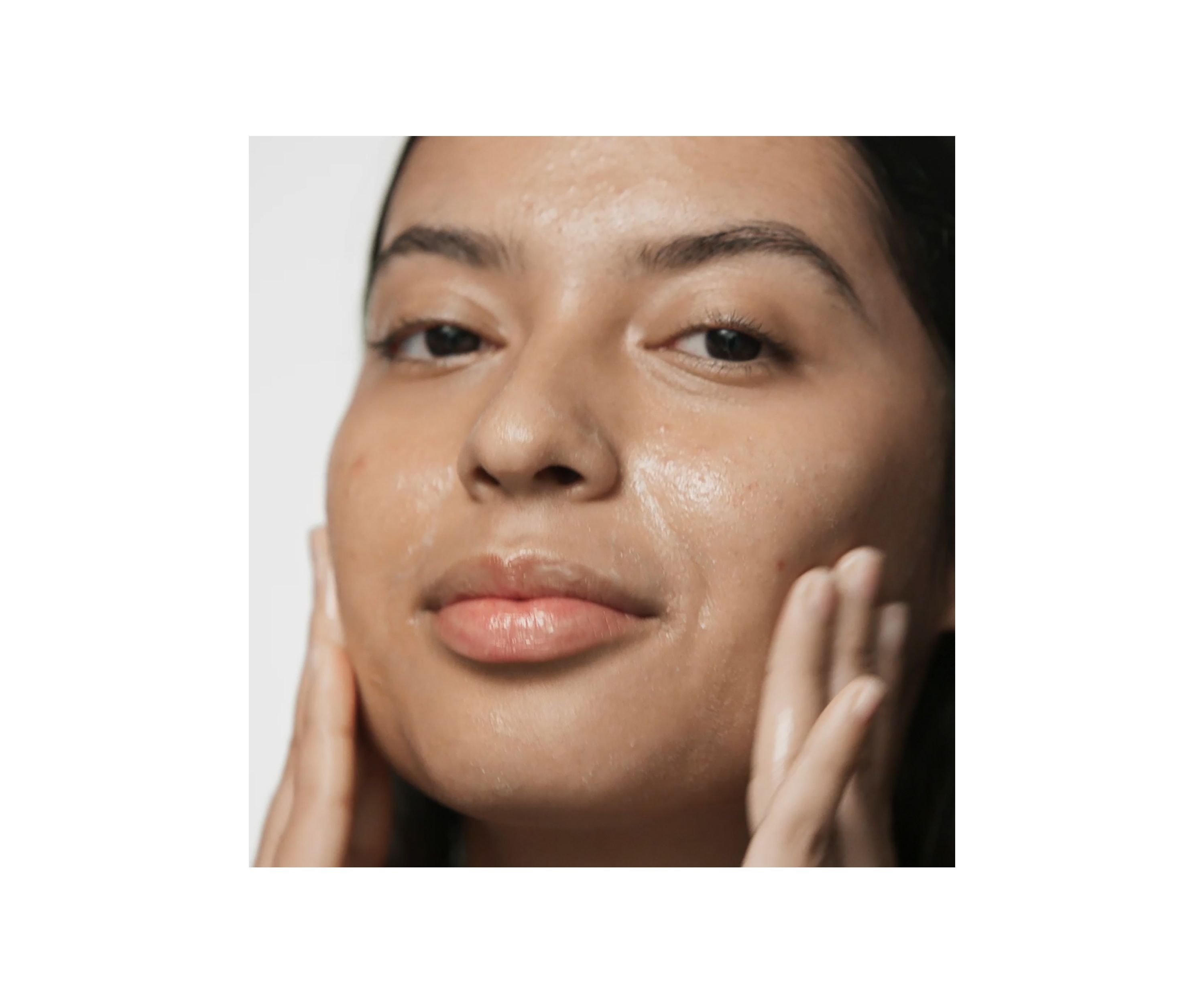 Acne Solutions™ Cleansing Gel with Salicylic Acid