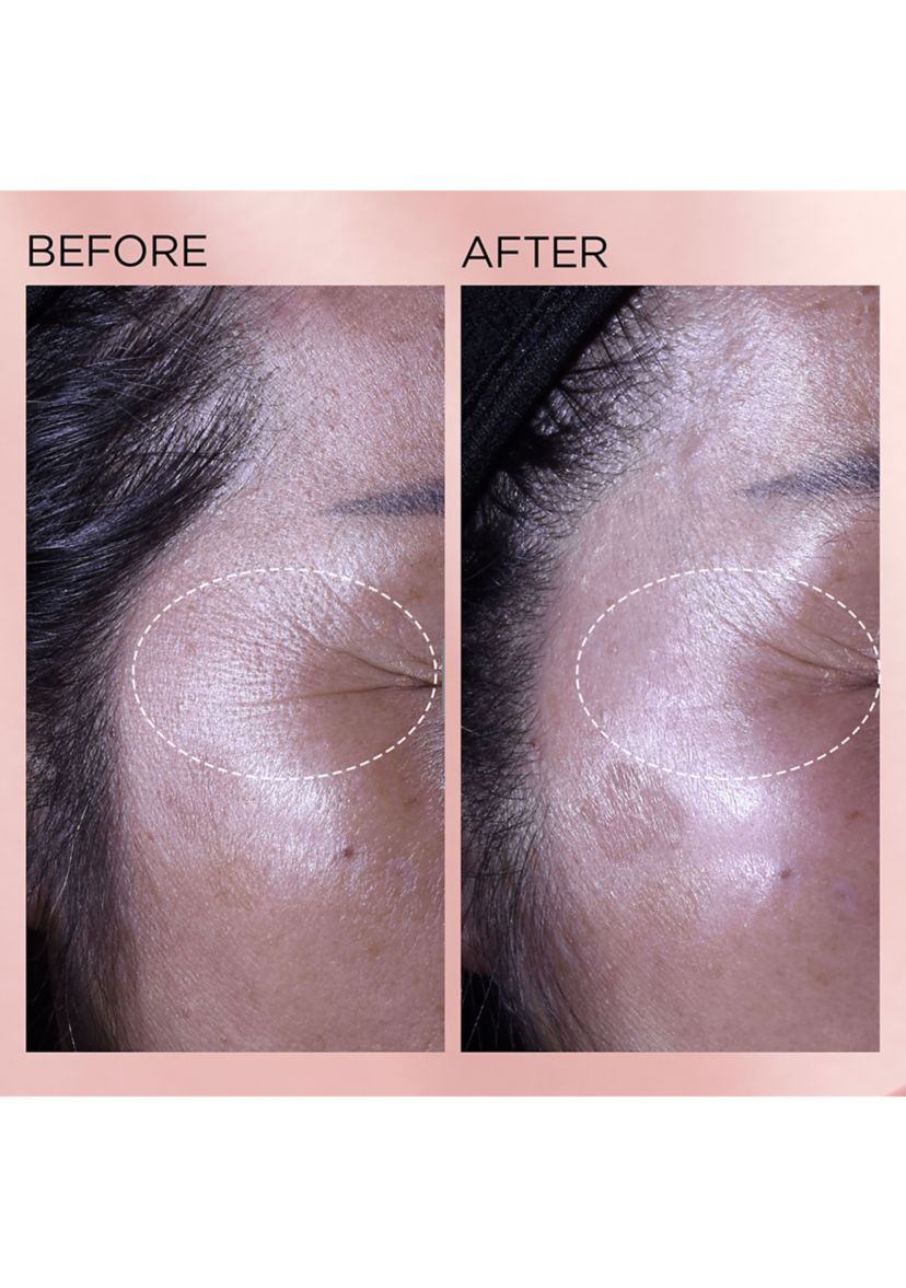 Retinol + HPR Ceramide Capsules Rapid Skin Renewing Serum