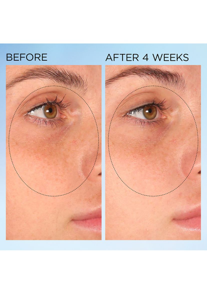 Visible Brightening Clearly Radiant Spot Correcting Capsules