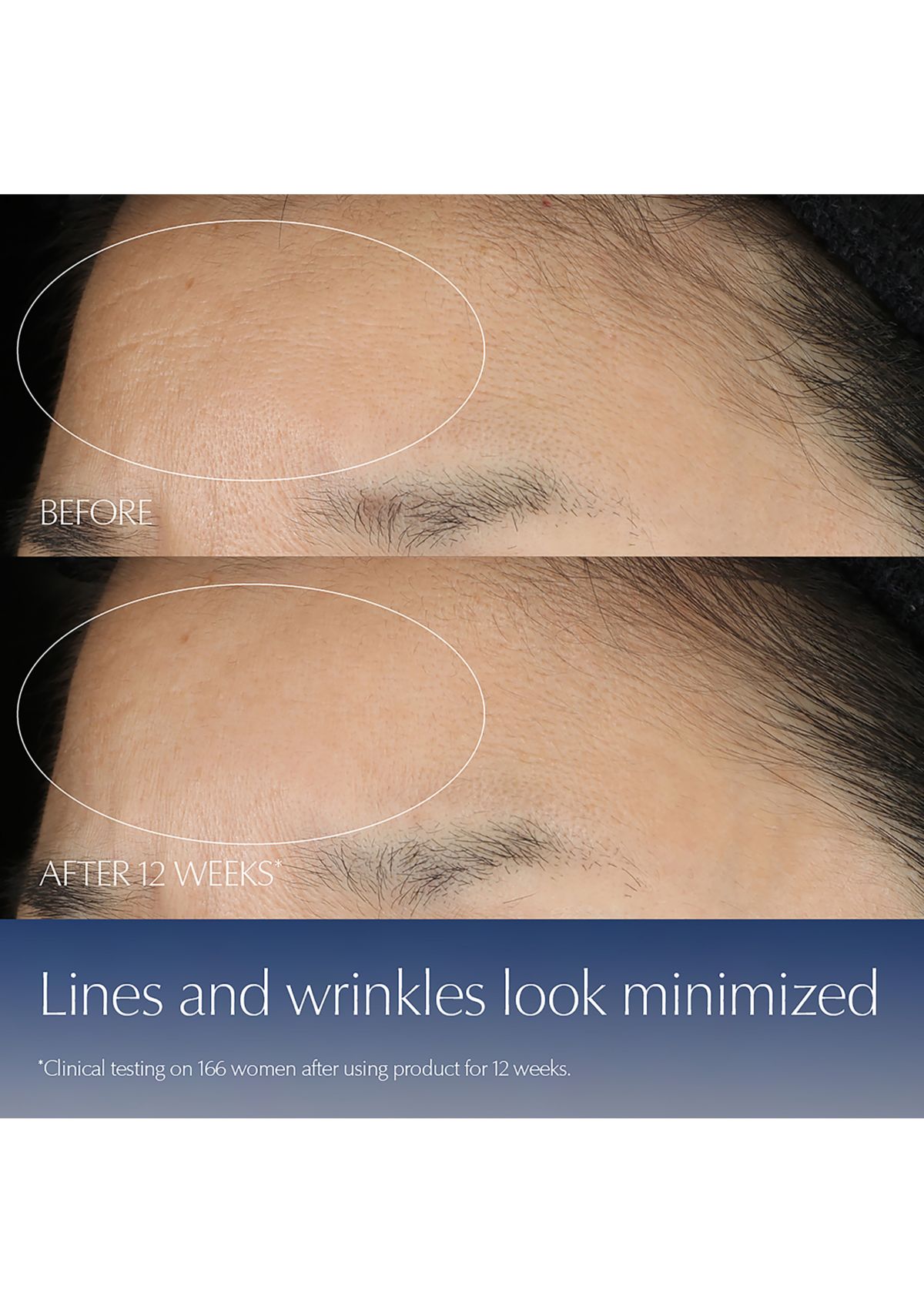 Advanced Night Repair Synchronized Multi-Recovery Complex Serum with Hyaluronic Acid & Peptides