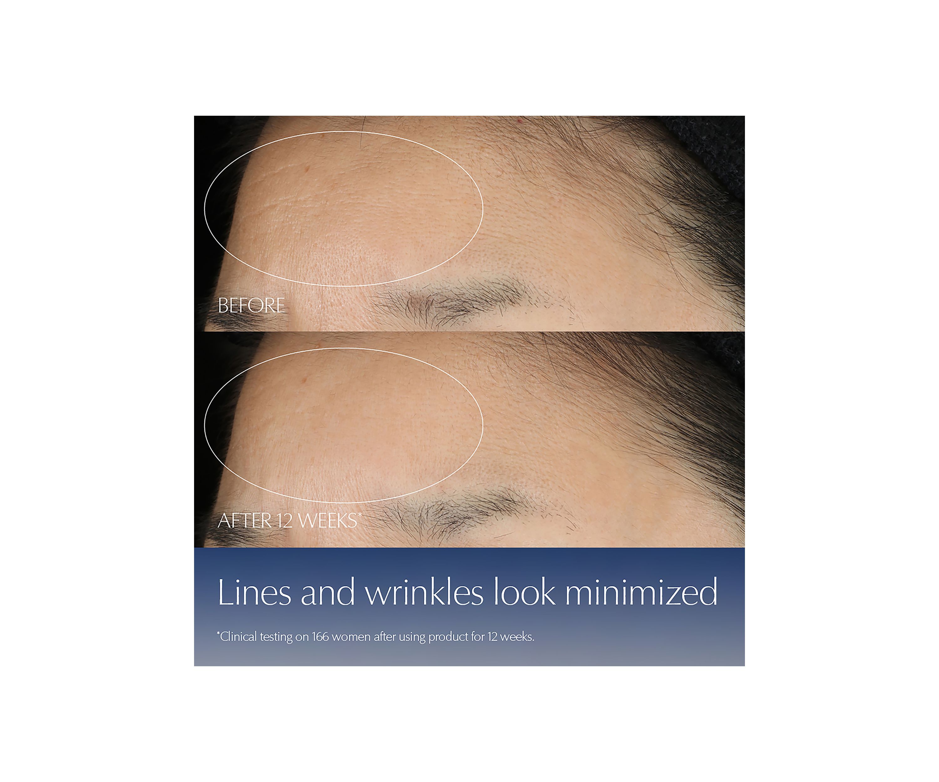Advanced Night Repair Synchronized Multi-Recovery Complex Serum with Hyaluronic Acid & Peptides